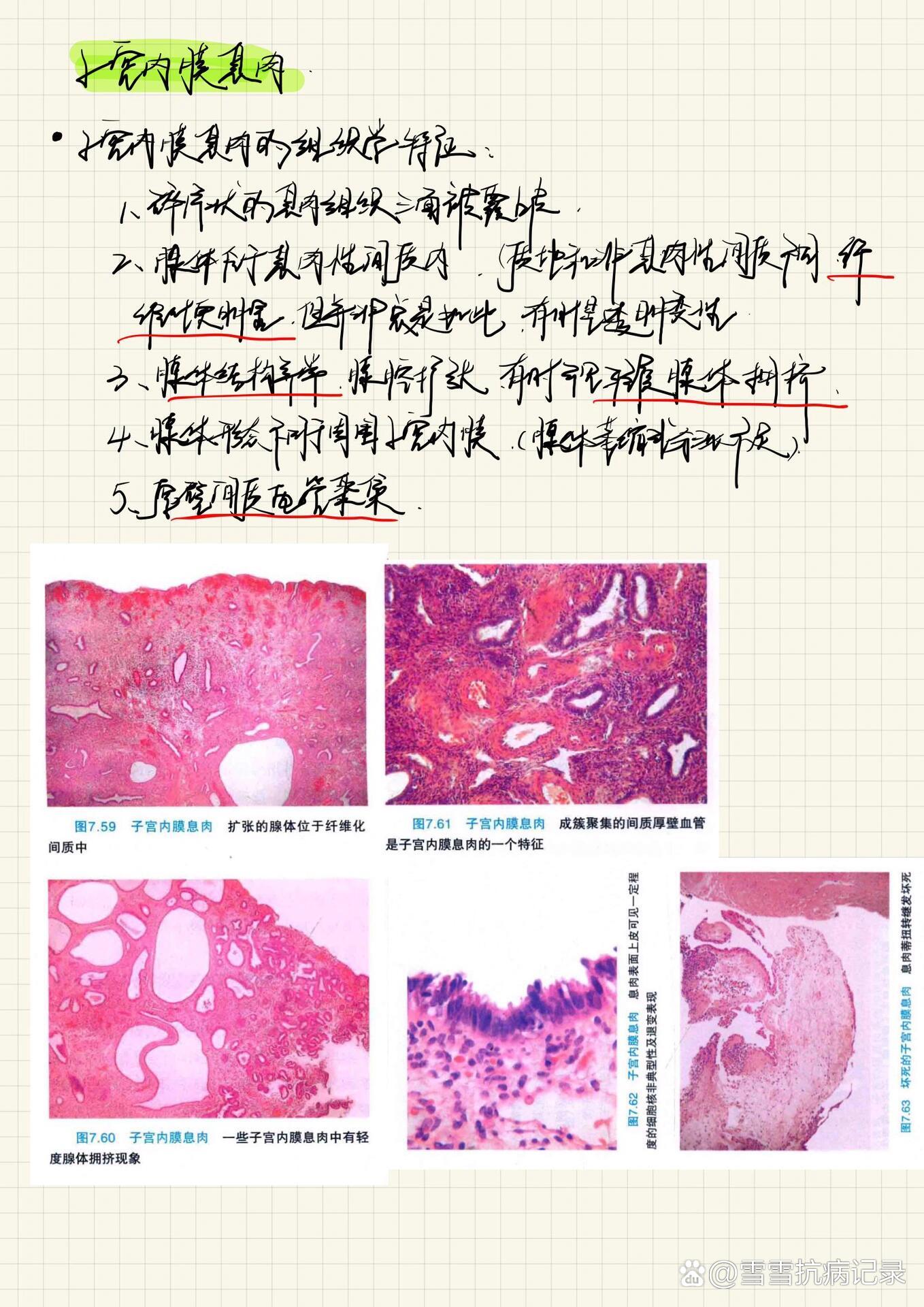 子宫内膜息肉标本图片