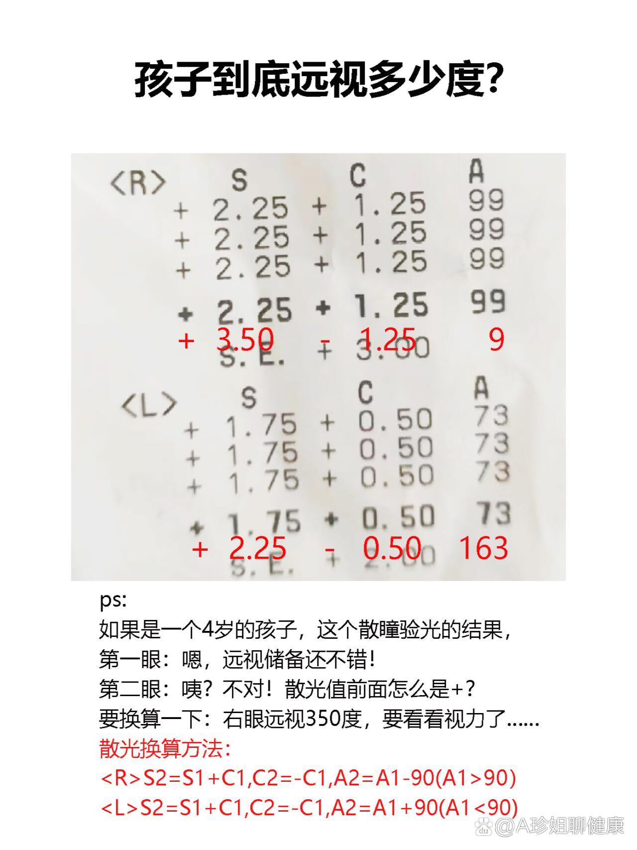  br>如果是一个4岁的孩子,这个散瞳验光的结果,  br>第一眼:嗯,远视