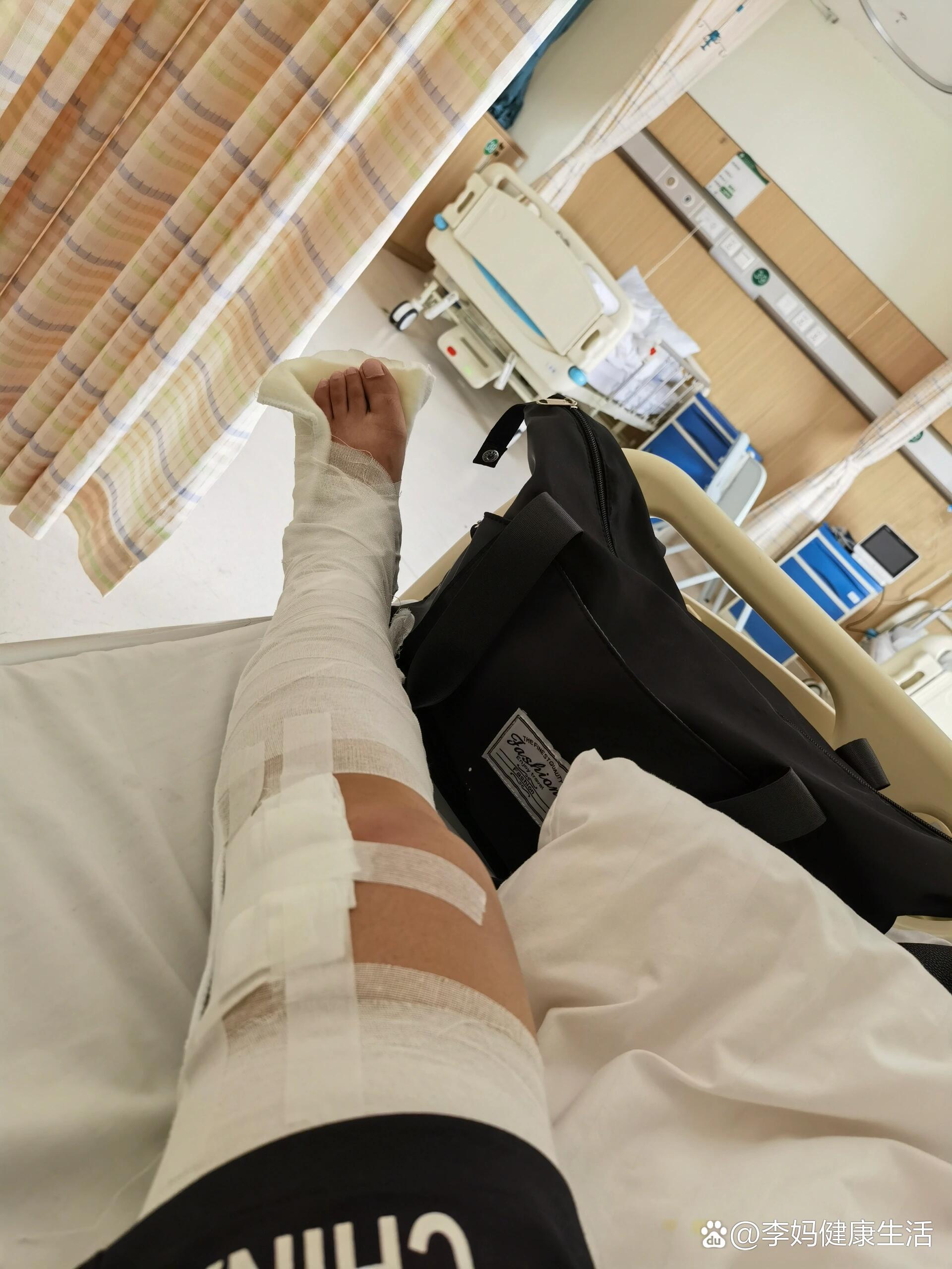 左侧股骨外侧髁骨折手术后的第5天