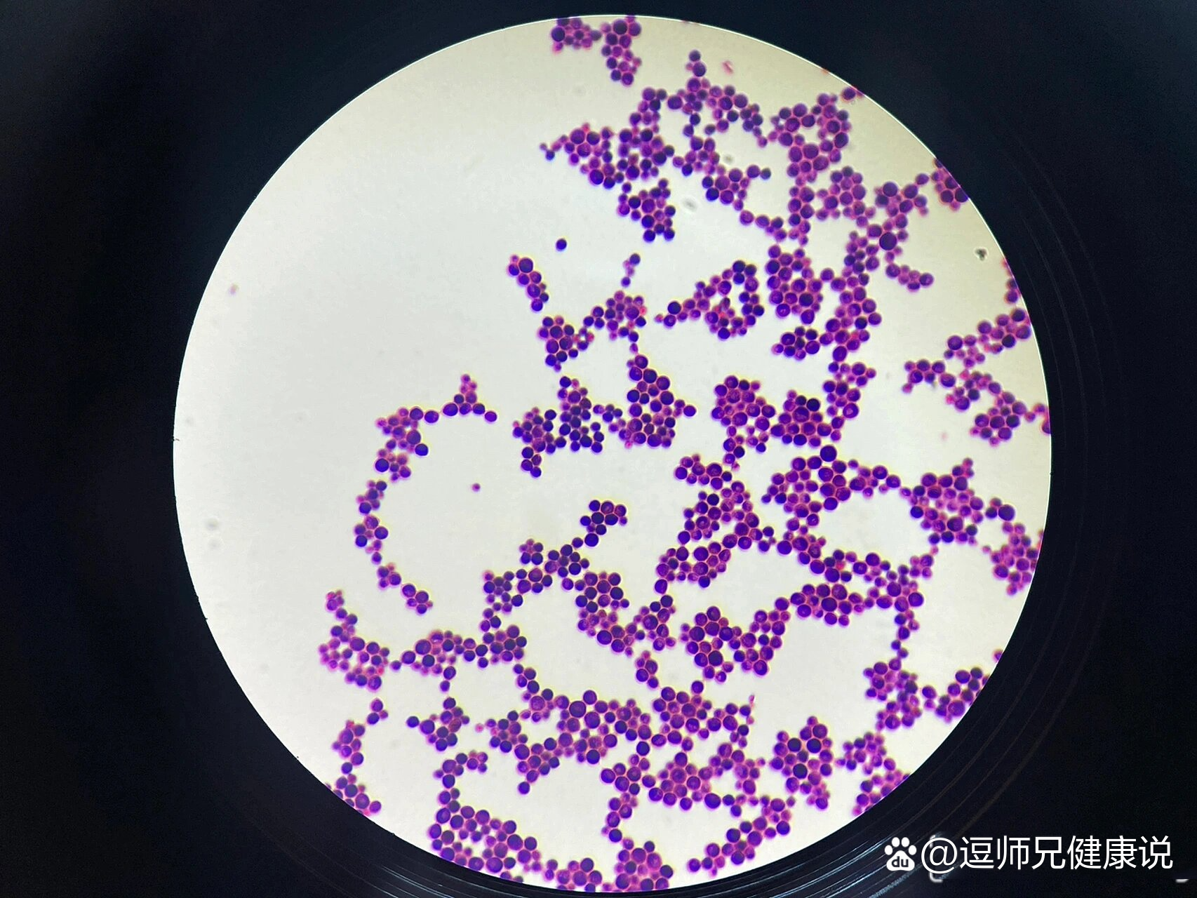 新生隐球菌显微镜图片