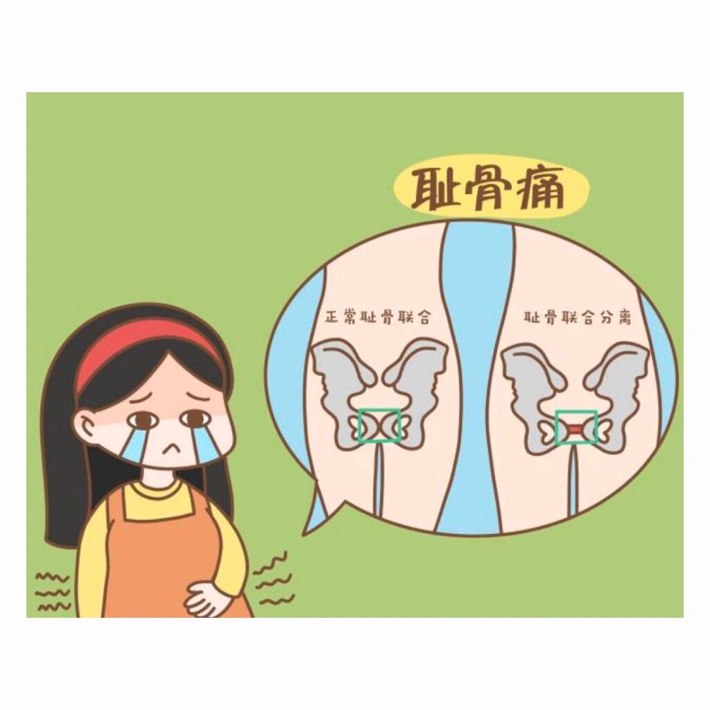 36周难逃耻骨痛!