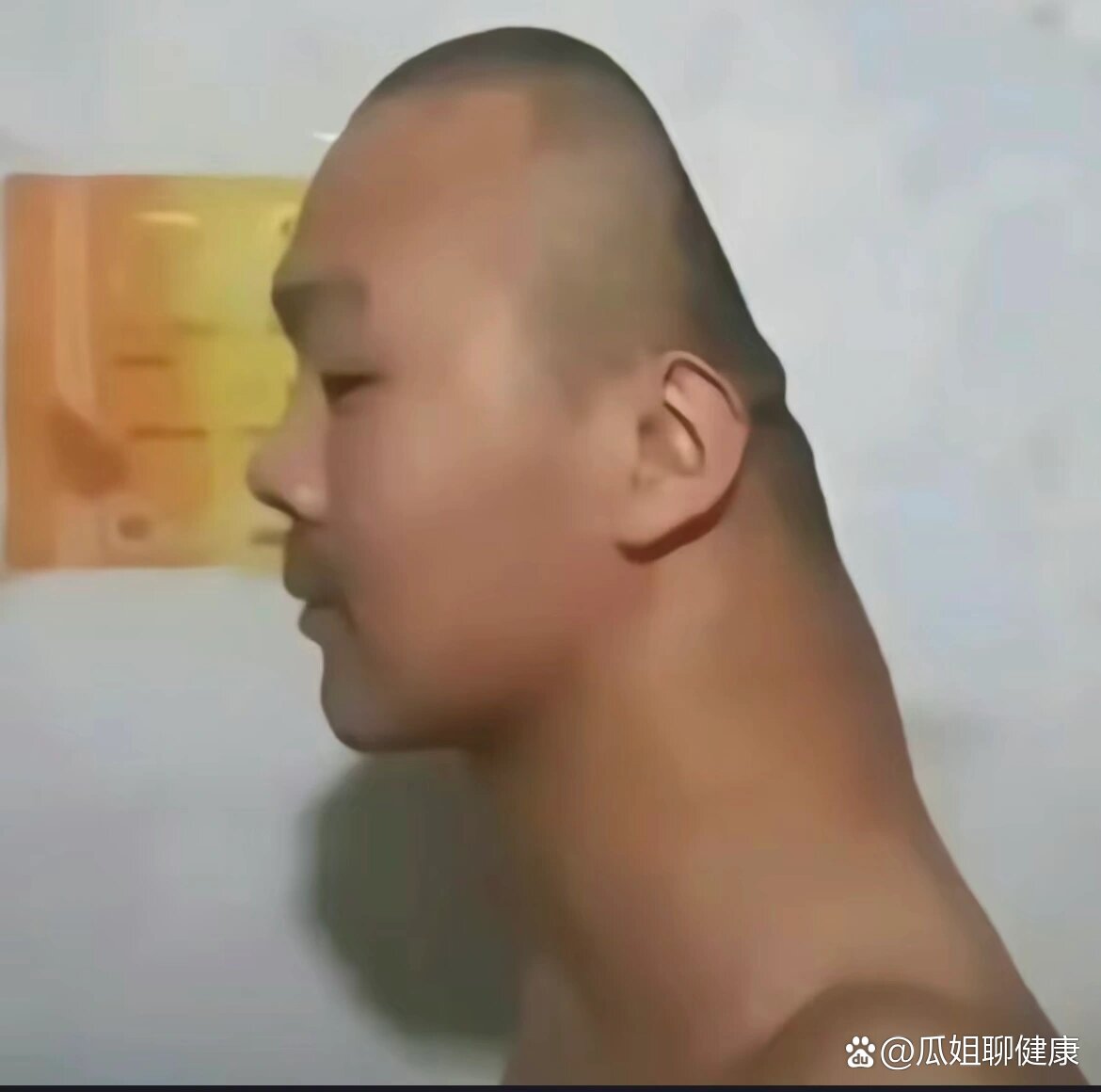 扁头对颈椎不好