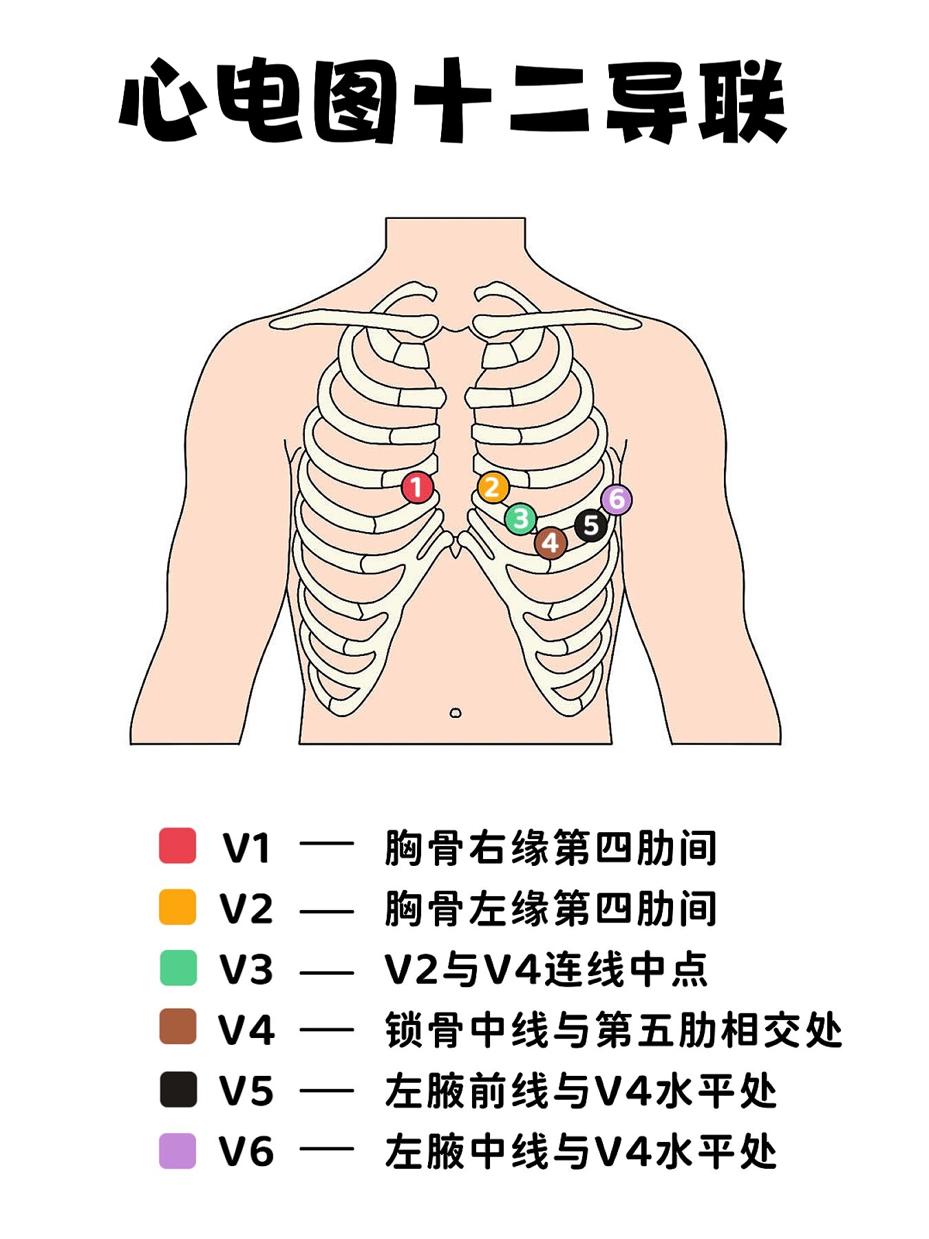 胸导联v1到v6的位置图片