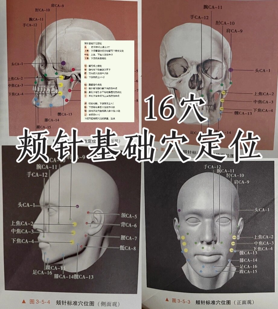 颊针