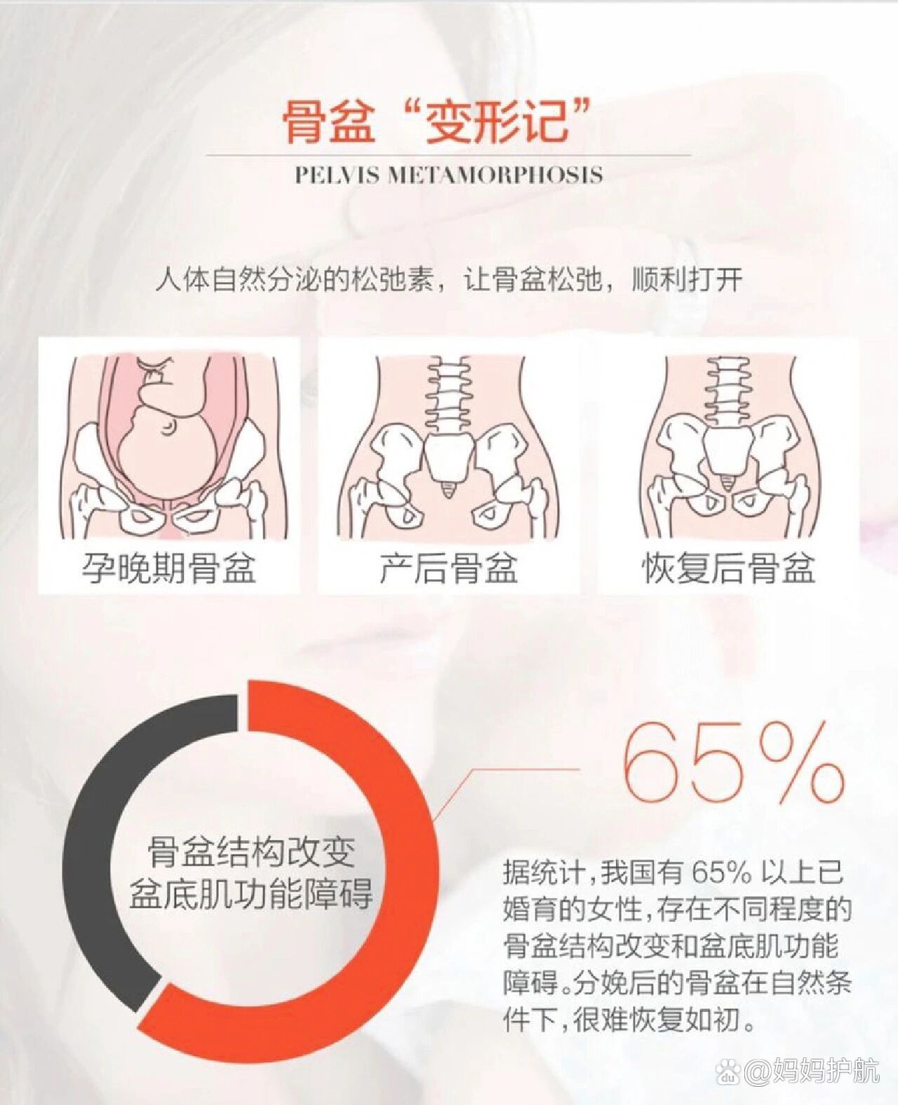 骨盆修复有必要做吗?
