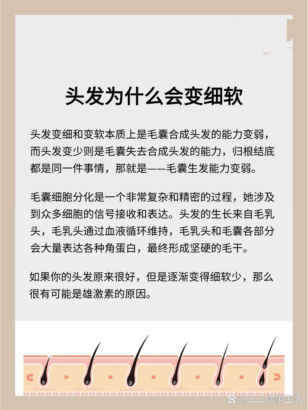 头发变细和变软本质上是毛囊合成头发的能力变弱而头发变少则是