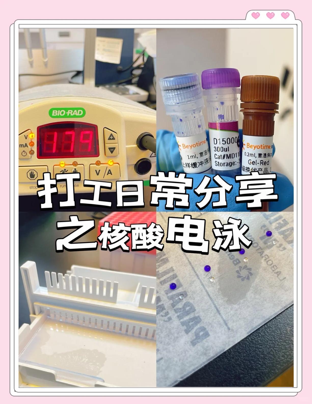 核酸电泳全攻略：RNA质量鉴定与跑胶技巧