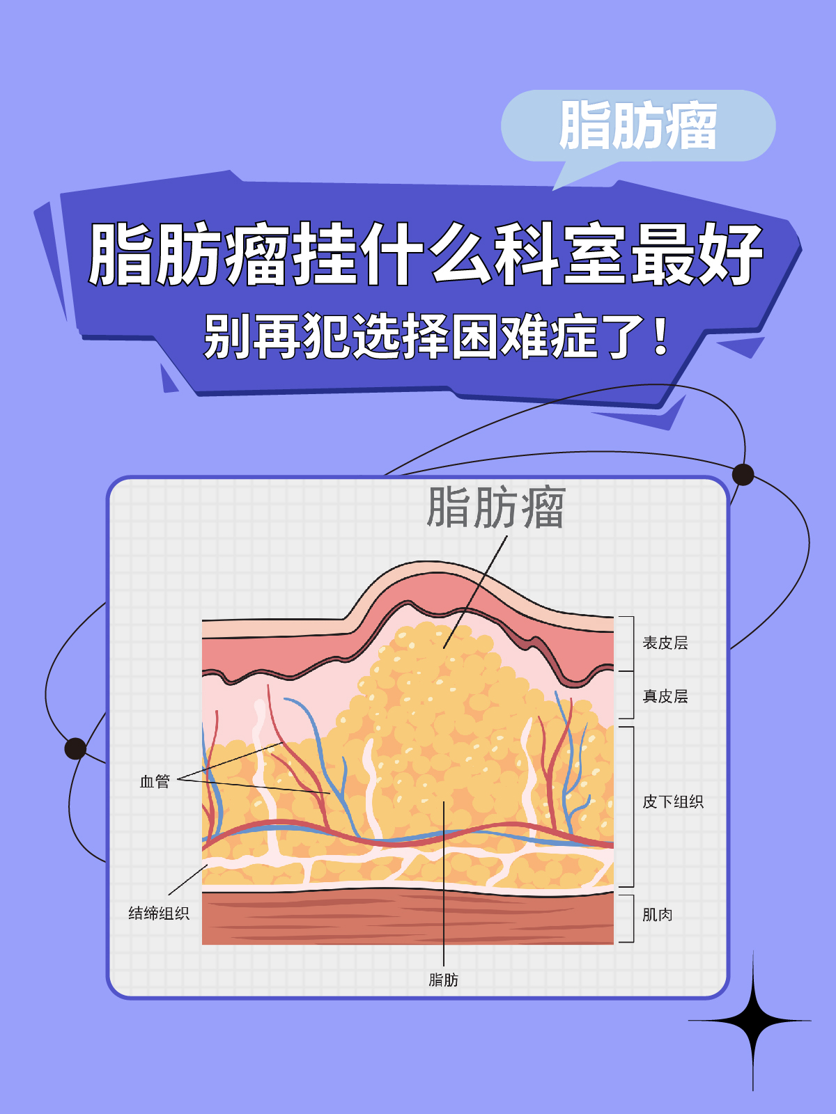 脂肪瘤应该挂什么科图片