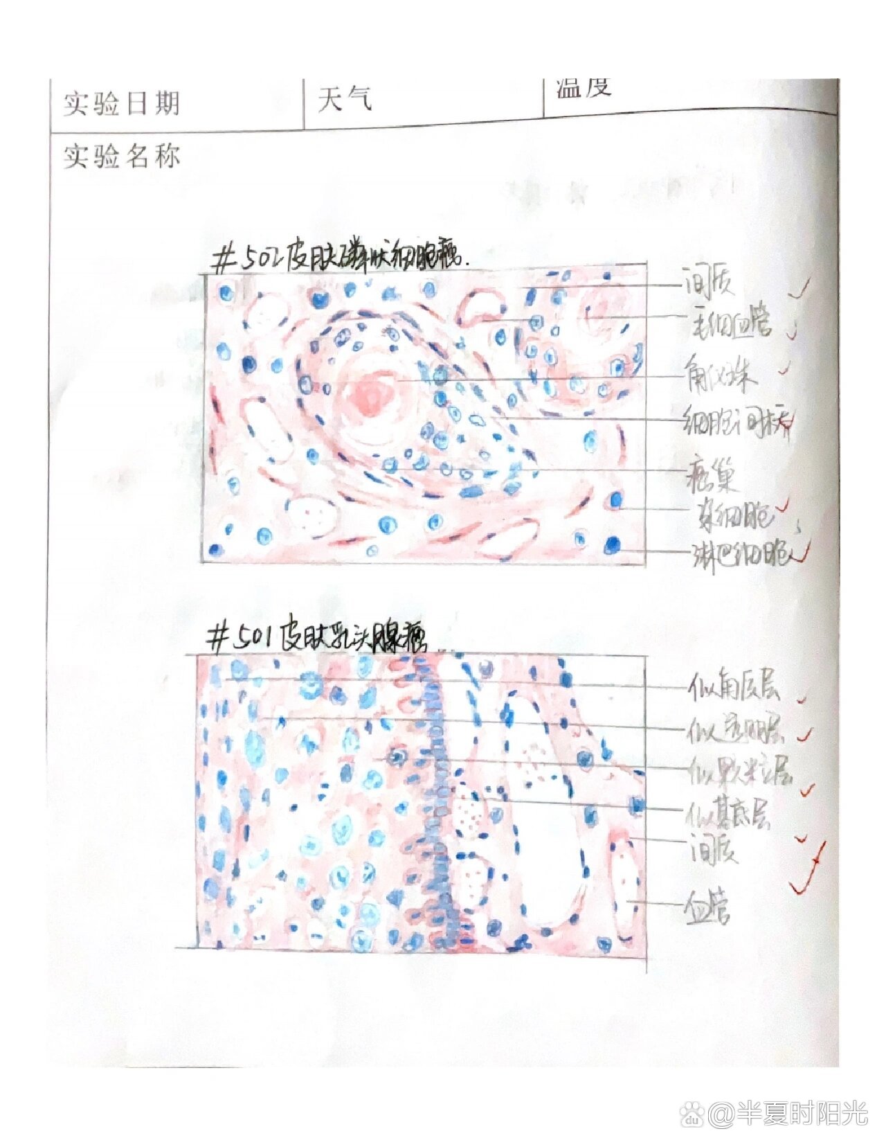 乳腺癌红蓝铅笔手绘图图片