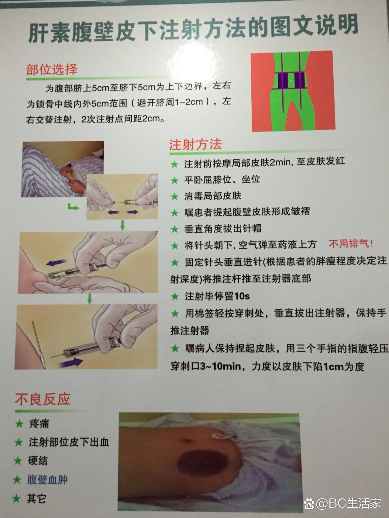 肝素打手臂图解 胳膊图片