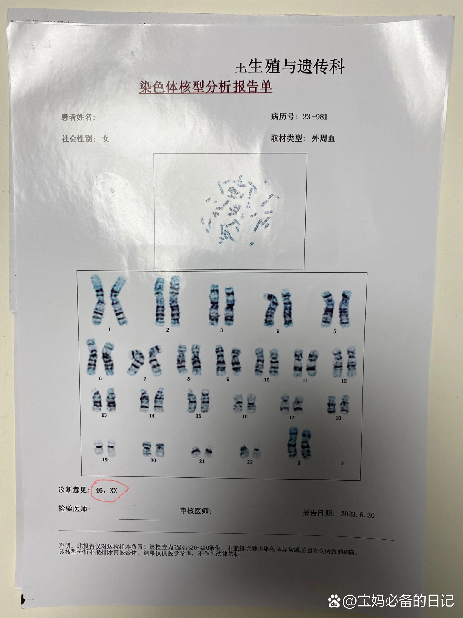 染色体结果出来了,胚胎三倍体