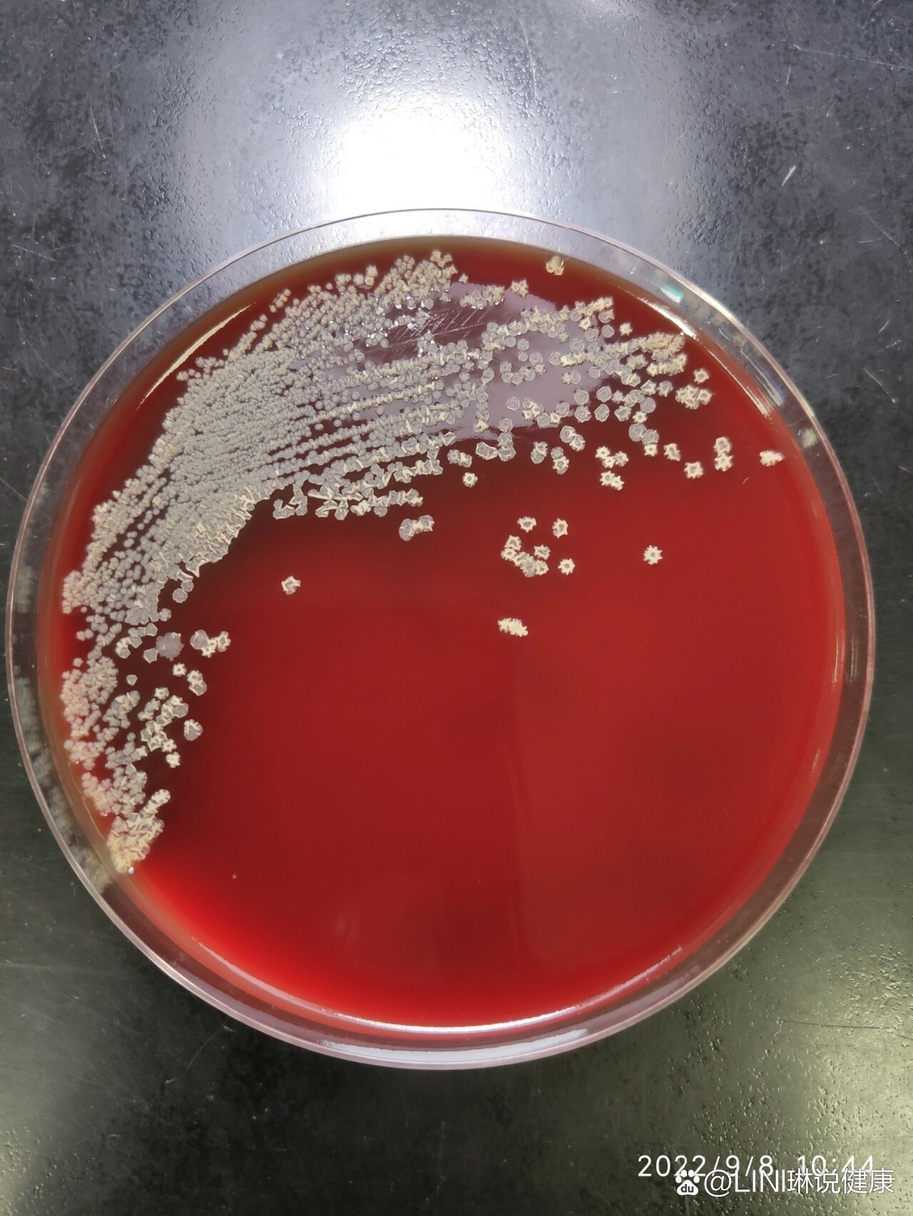 卡诺氏液高中生物实验图片