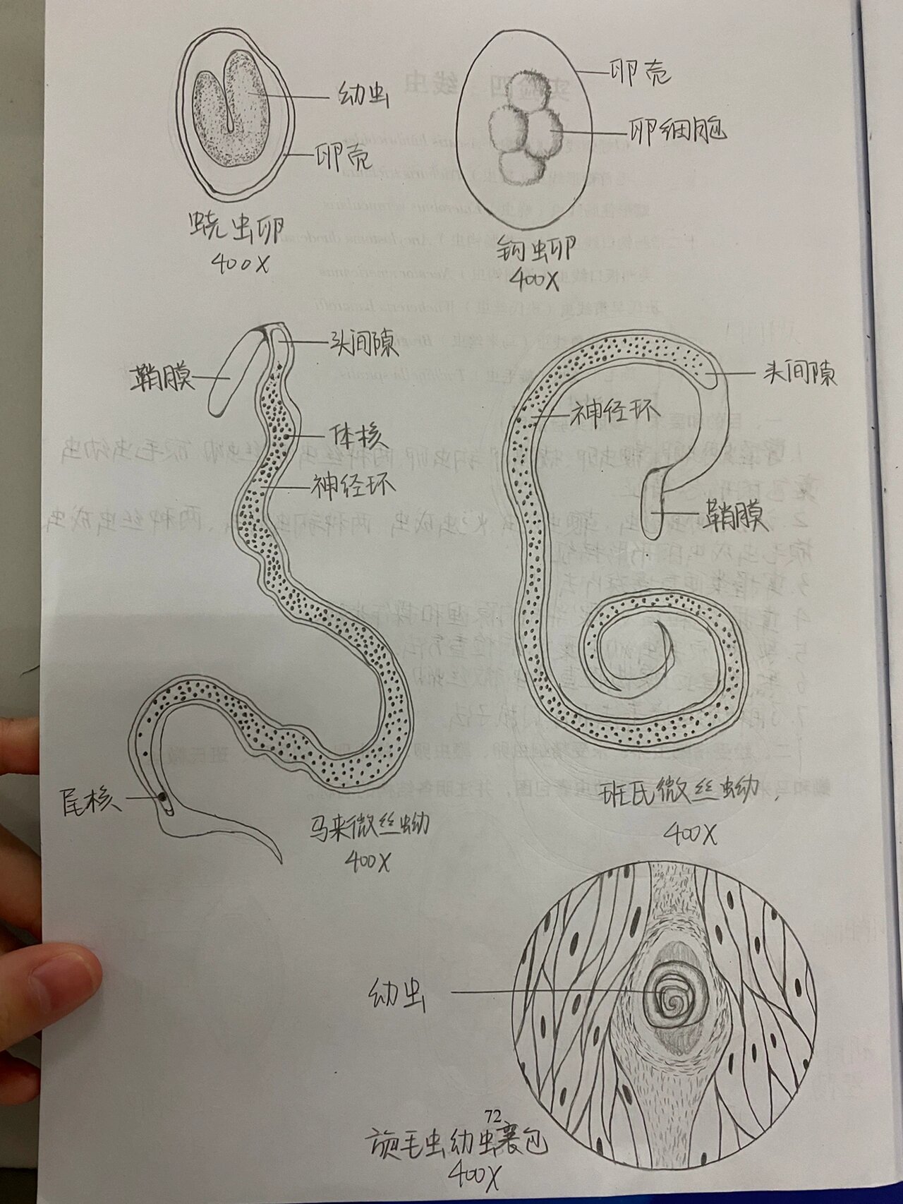 人体最大寄生虫图片