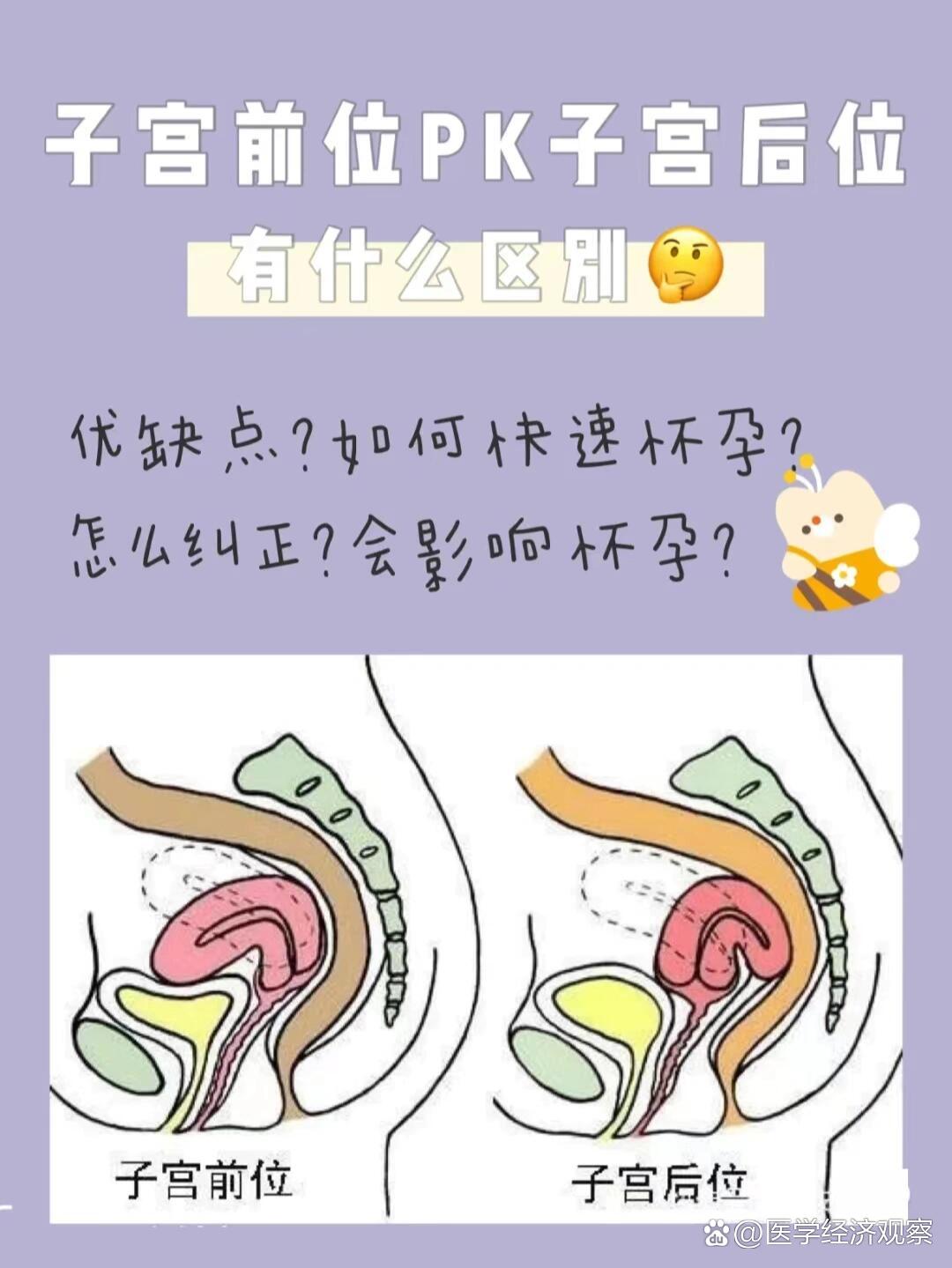 子宫前pk子宫后位有啥区别!