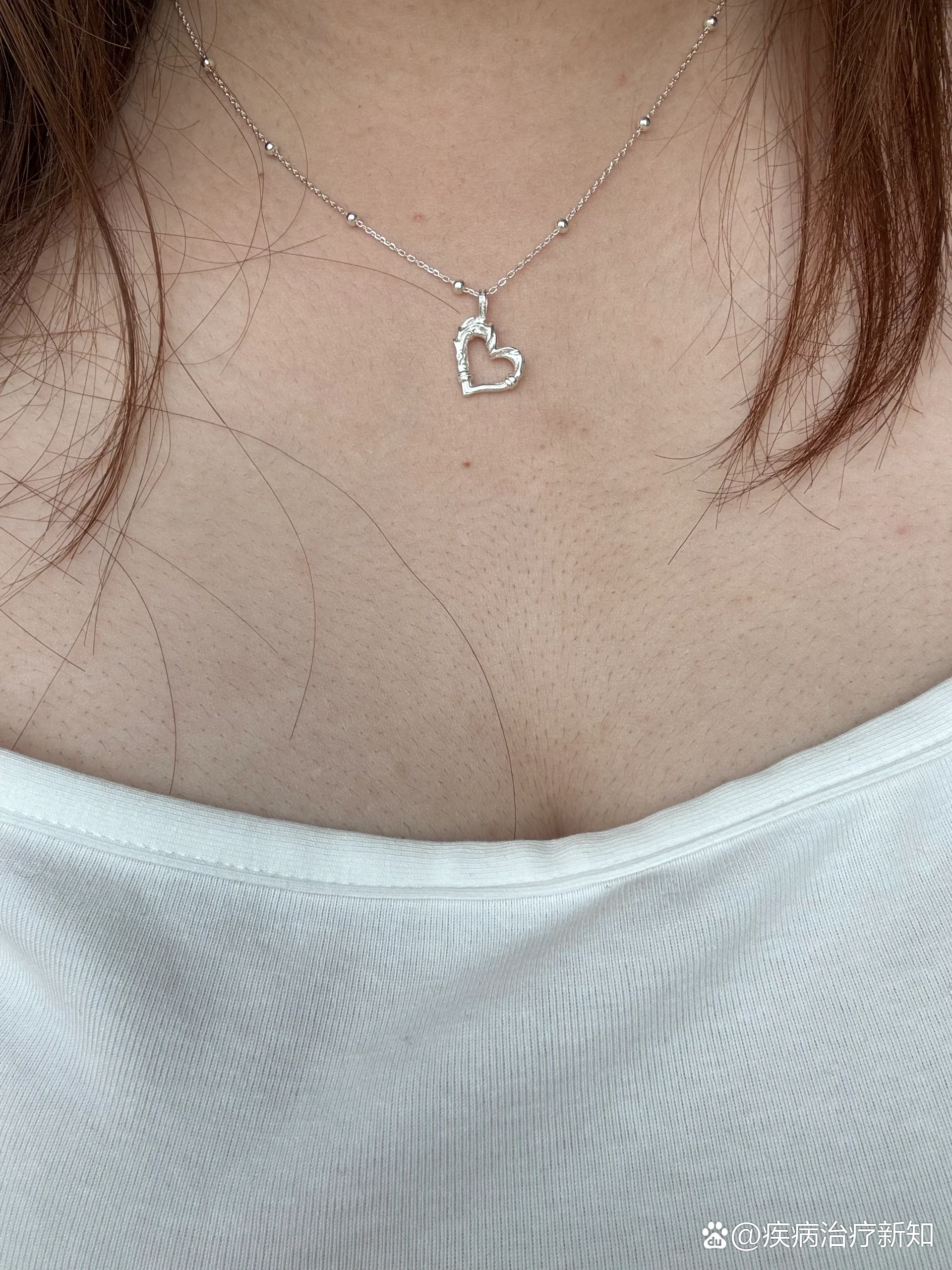 女孩子,不仅腿毛 手毛 腋毛旺盛,还有小胡子,连胸上都是大毛孔和绒毛