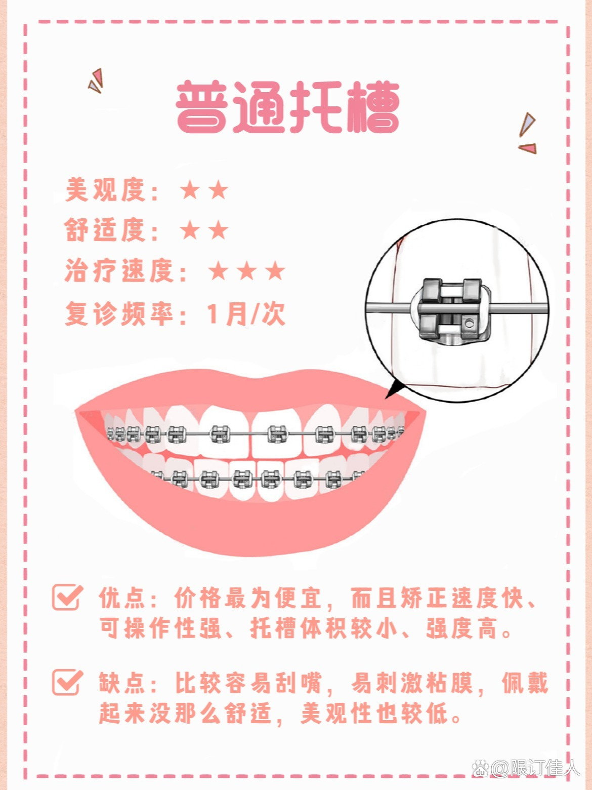 牙套粉色垫牙图片