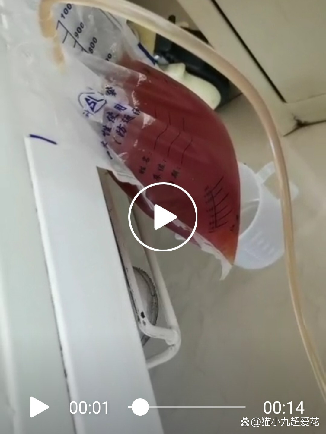 肺积水是怎么回事