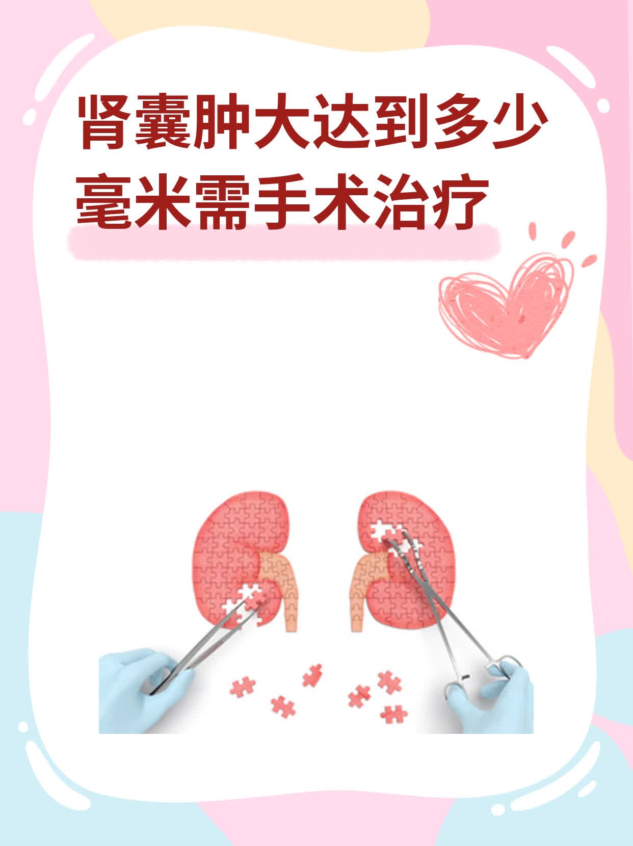 肾囊肿大达到多少毫米需手术治疗