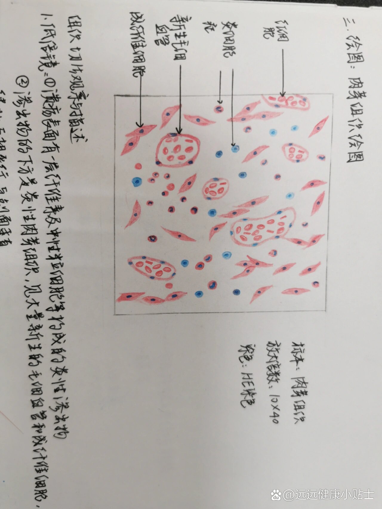 肉芽组织手绘图片