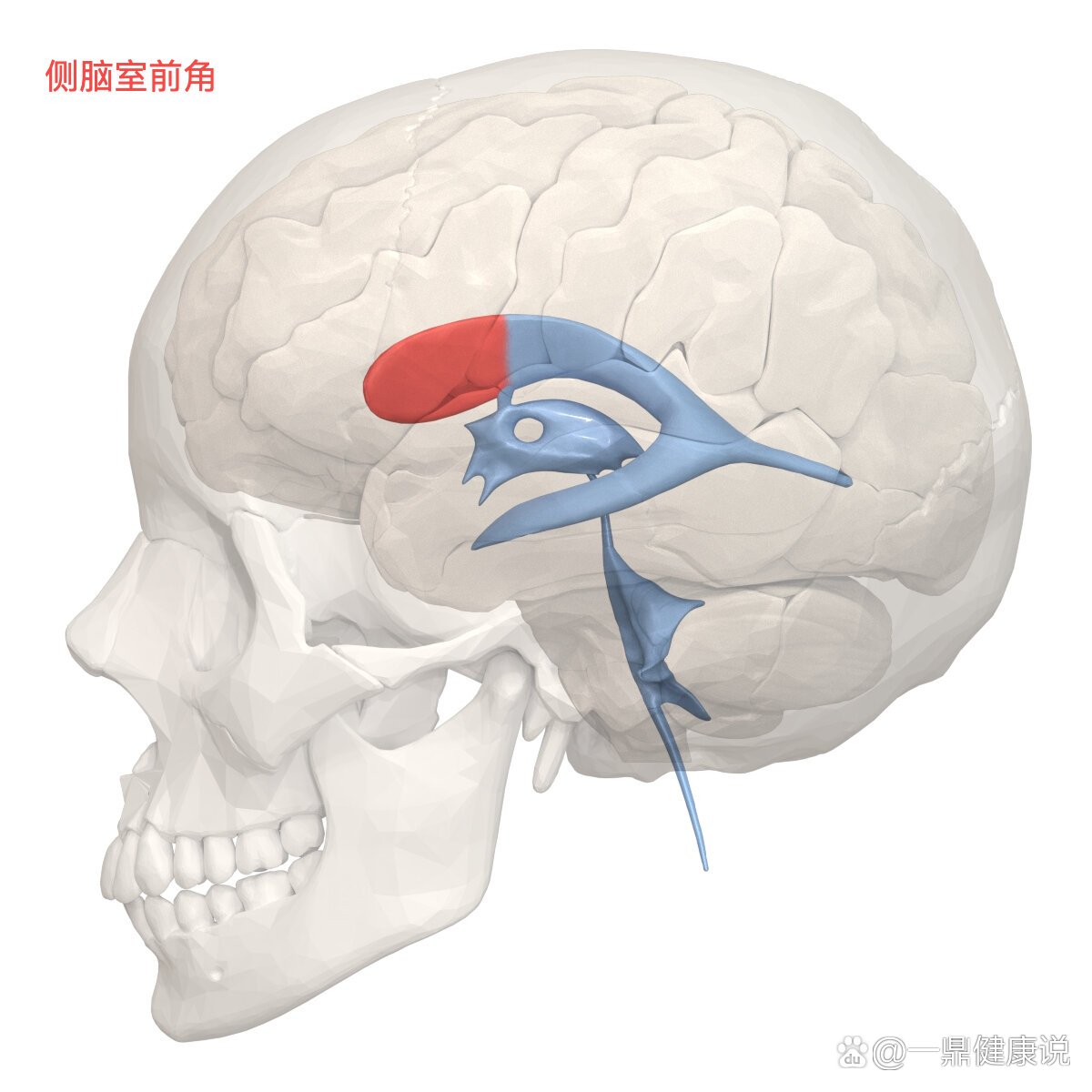 侧脑室影像图片图片