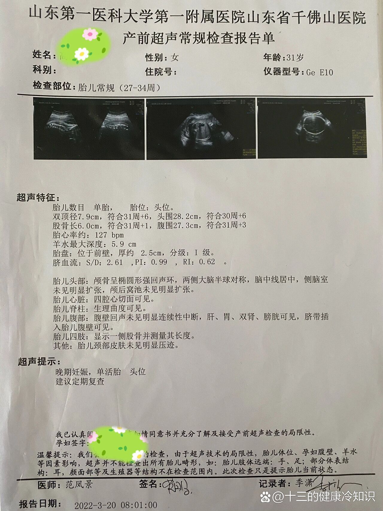 今天31 1,20 1的时候b超显示左心室有点状强回声