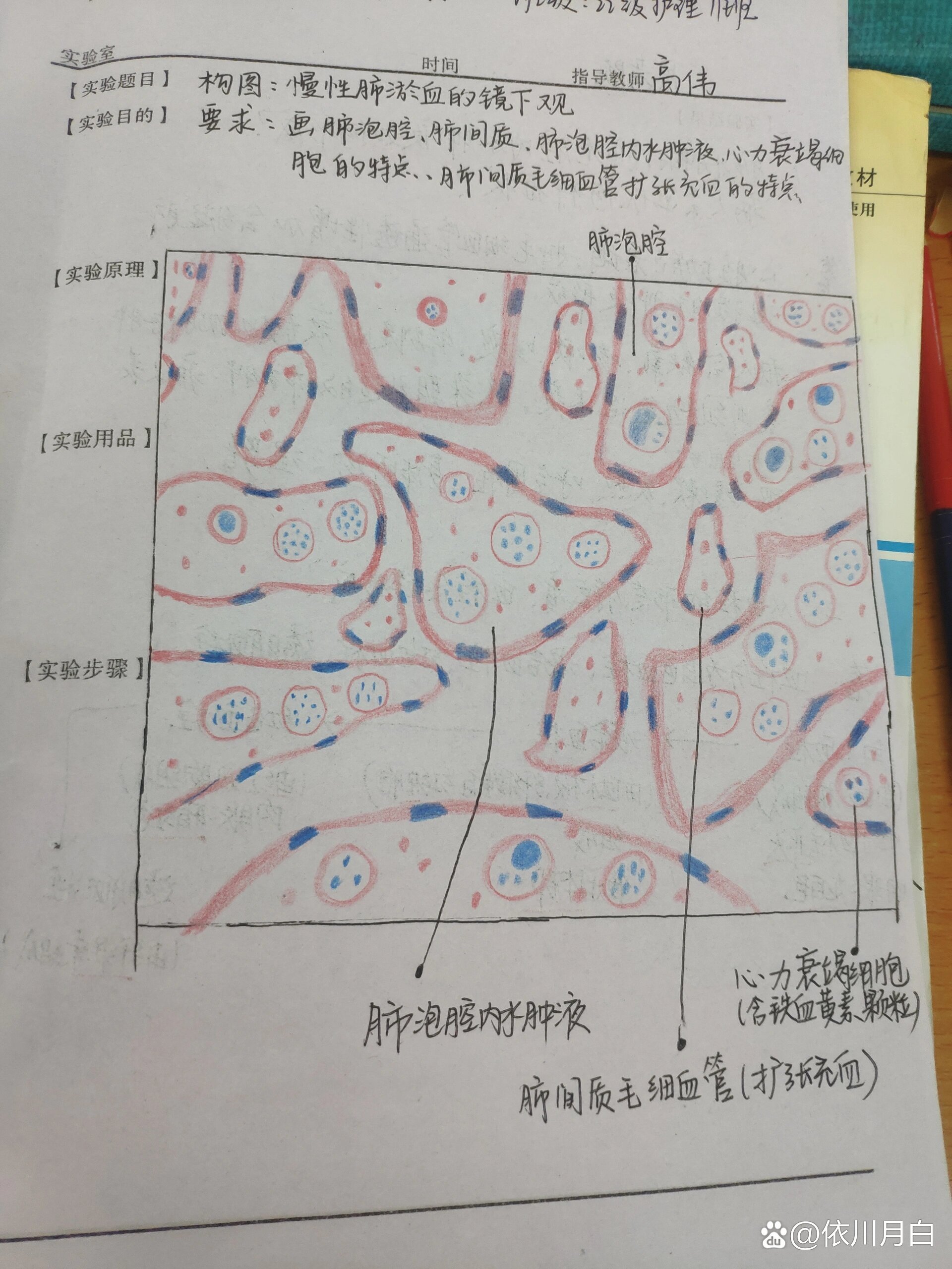 慢性肺淤血的镜下图片图片