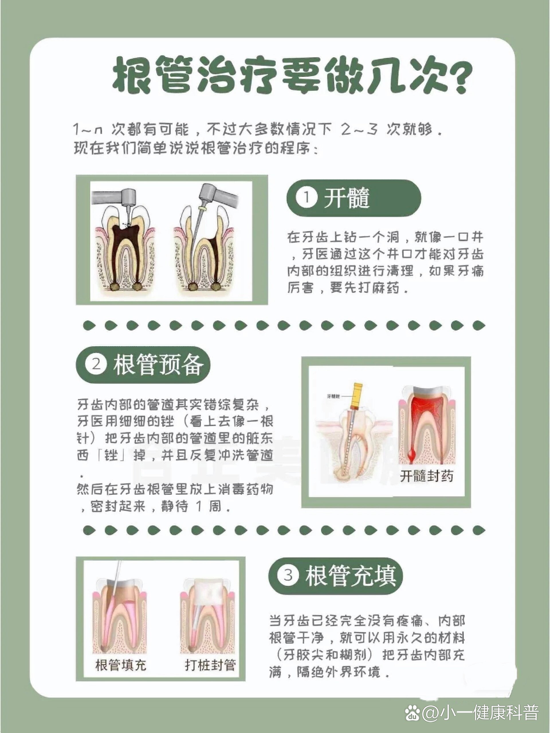 建根图片和用法图片