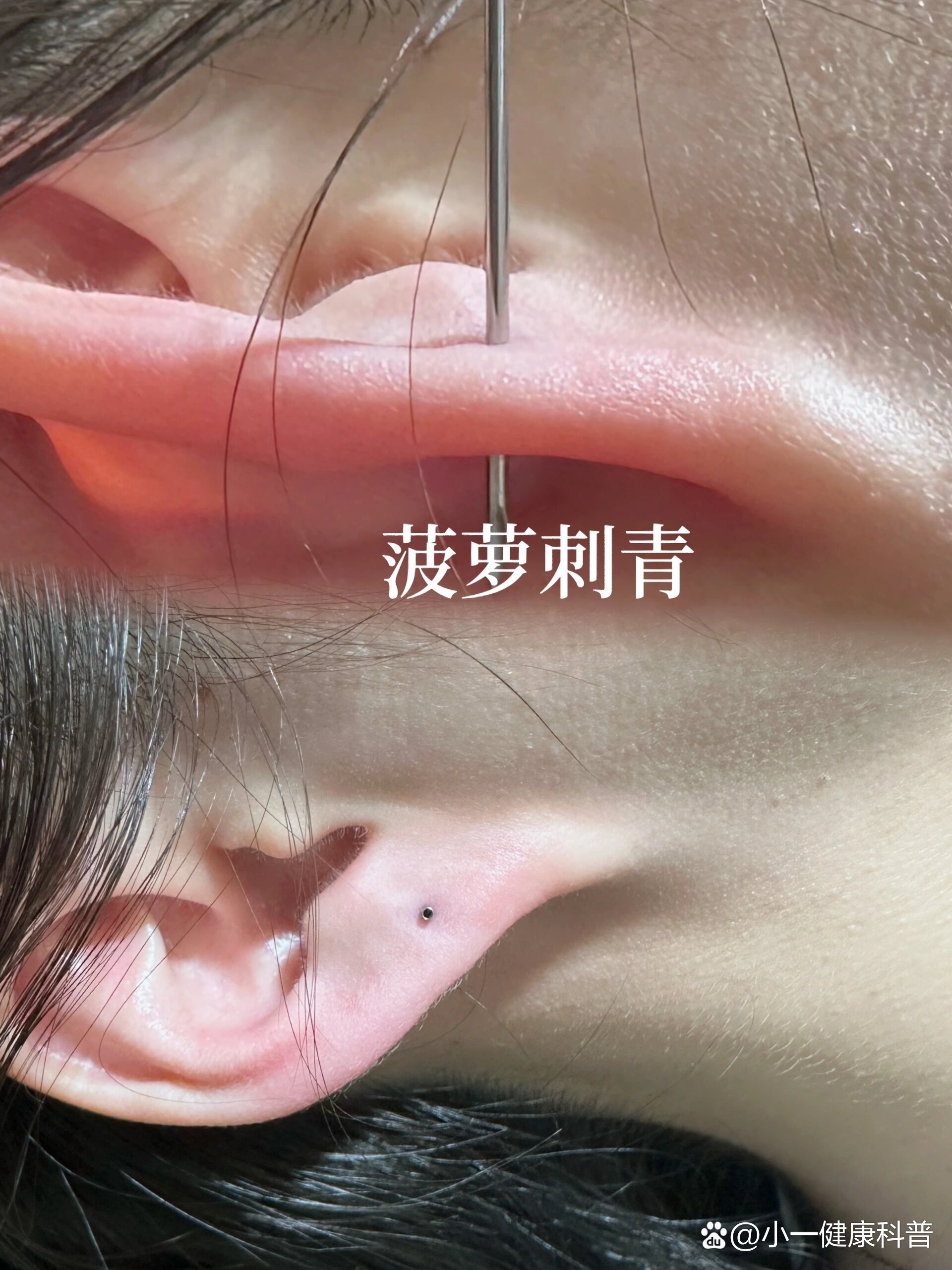经常会遇到没有耳垂或者耳垂比较小的客人,想戴好看的耳环却不知道能
