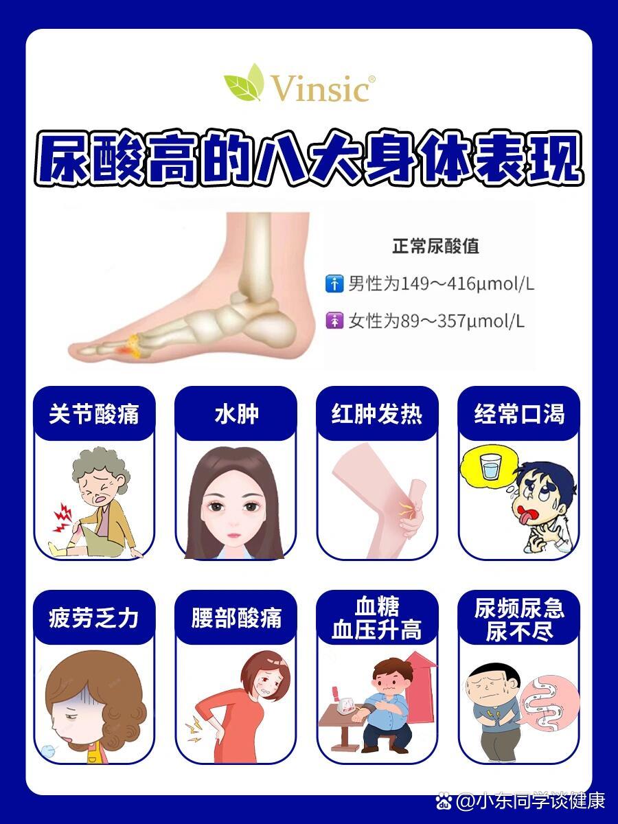 高尿酸的八个征兆,看看你有没有中招!