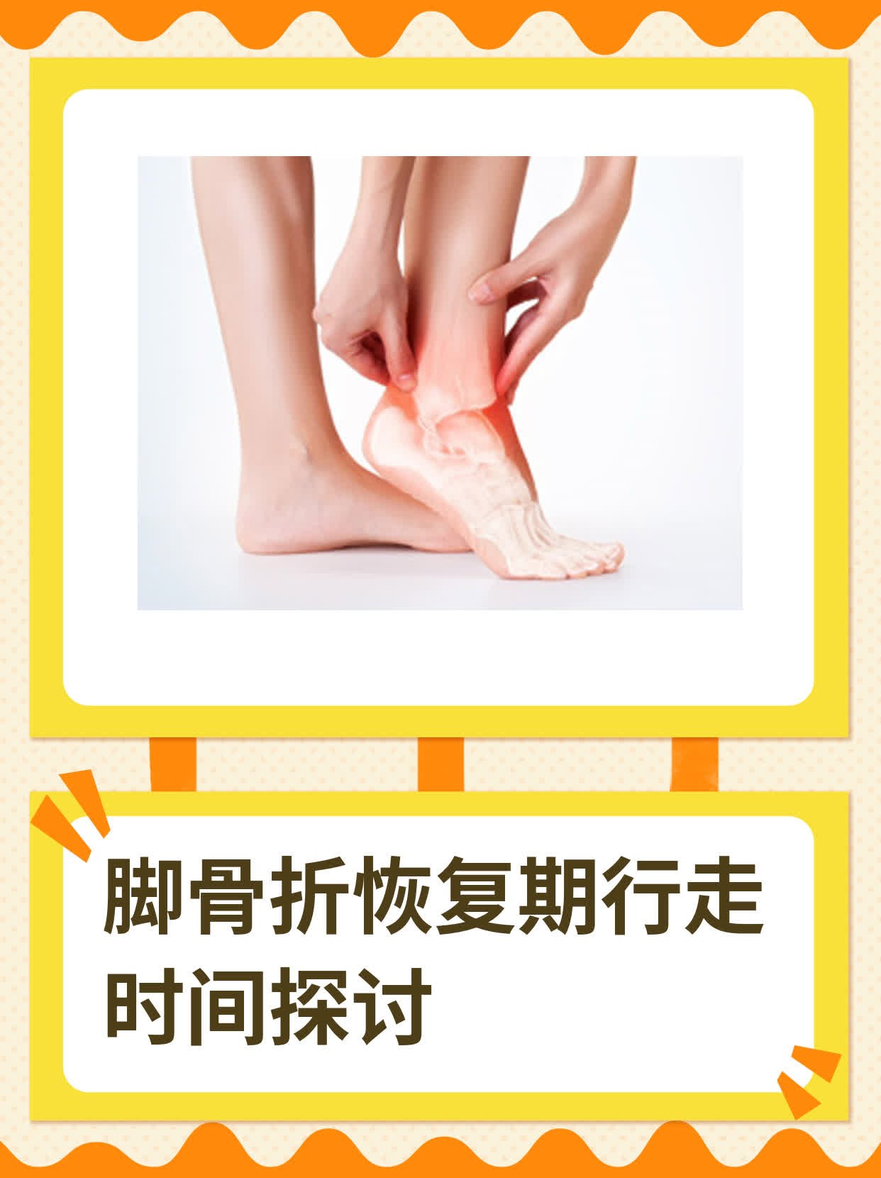 脚骨折恢复期行走时间探讨