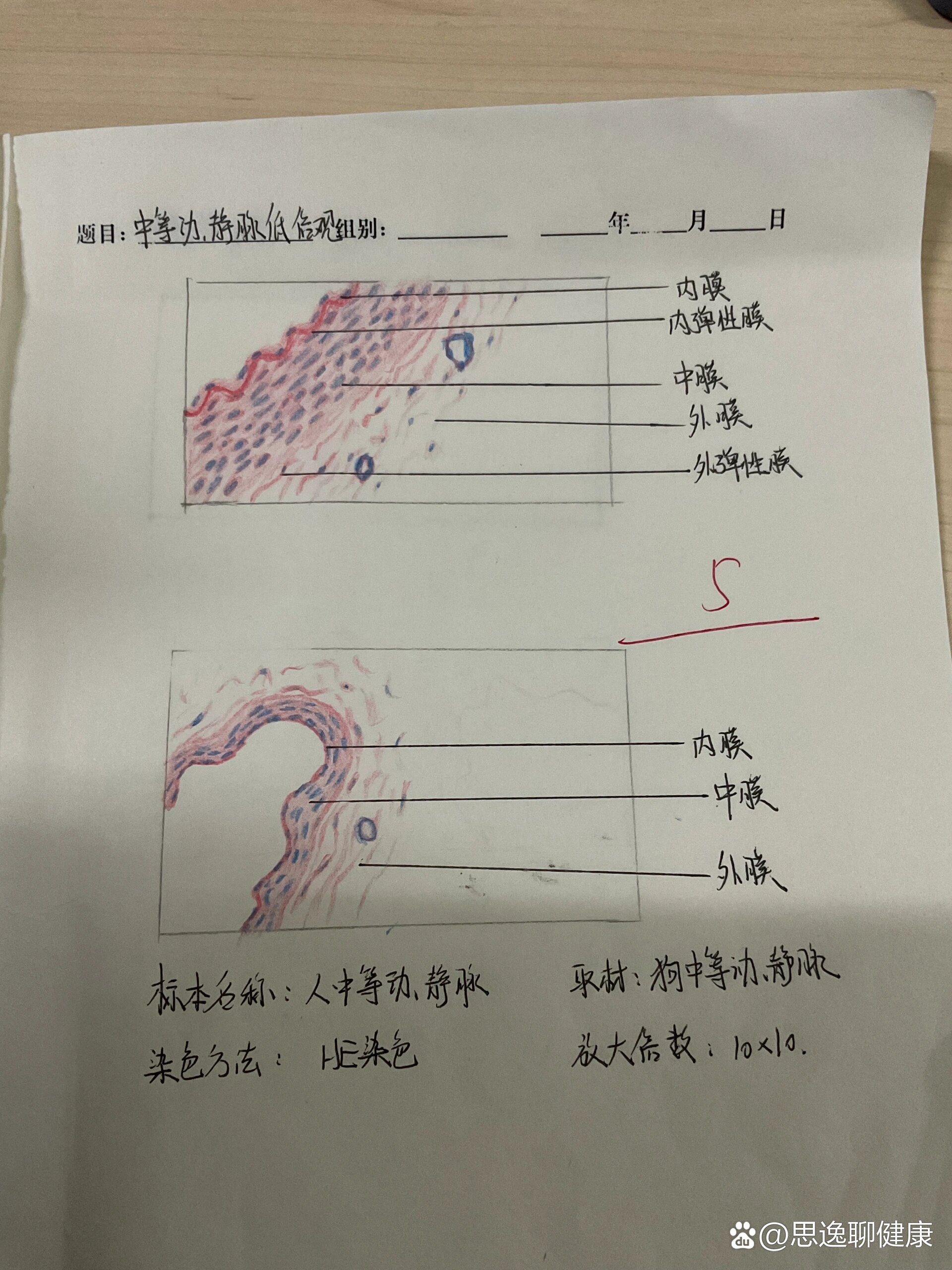 肠伤寒红蓝铅笔图图片