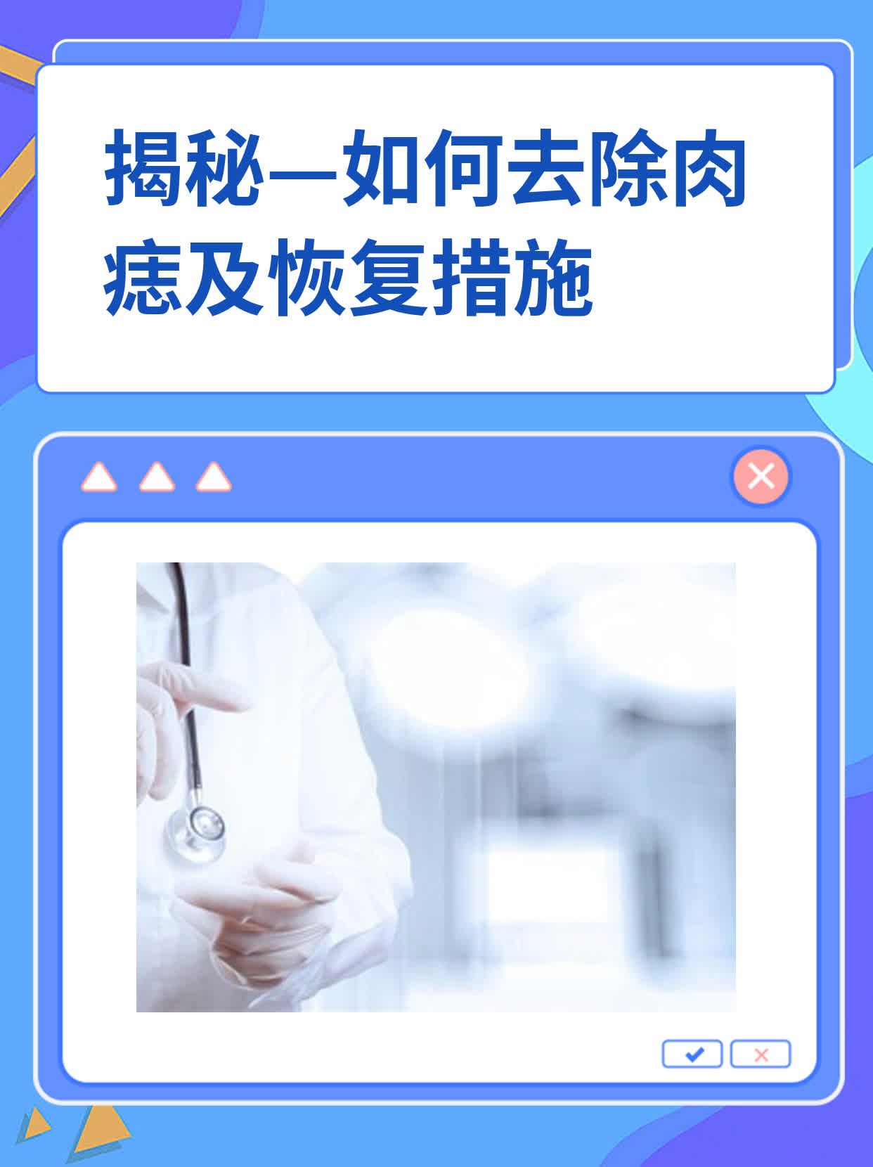 揭秘—如何去除肉痣及恢复措施