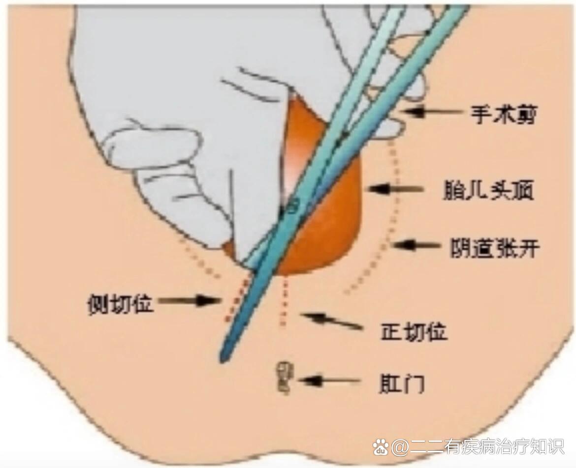 侧切图片真实图片