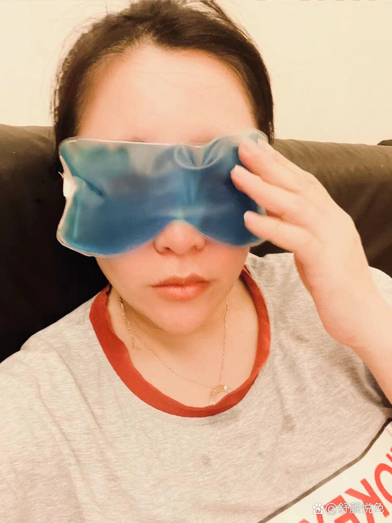 双眼皮术后冰敷真的很重要6015