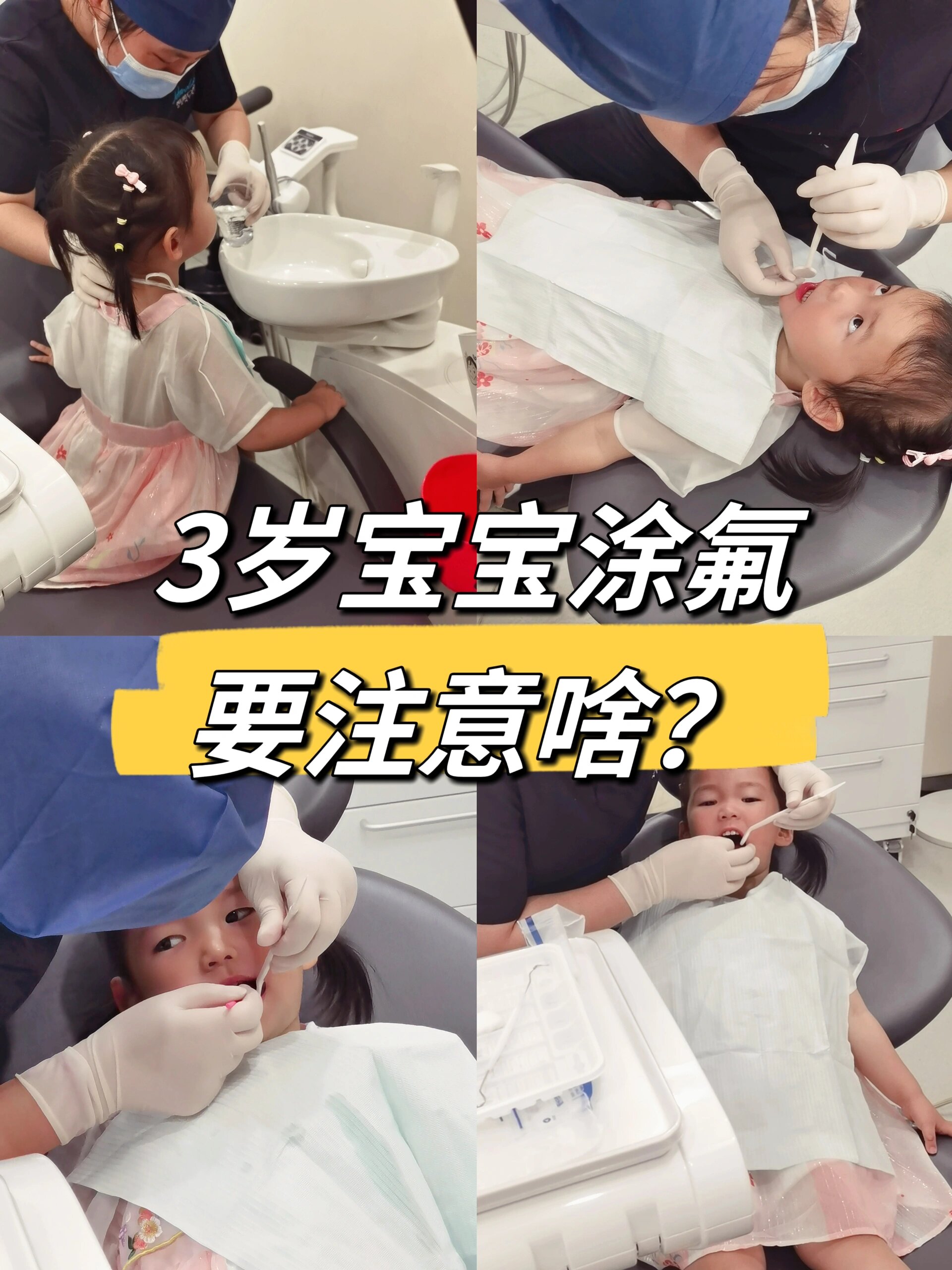 三岁宝宝涂氟要注意什么❓看这篇就够