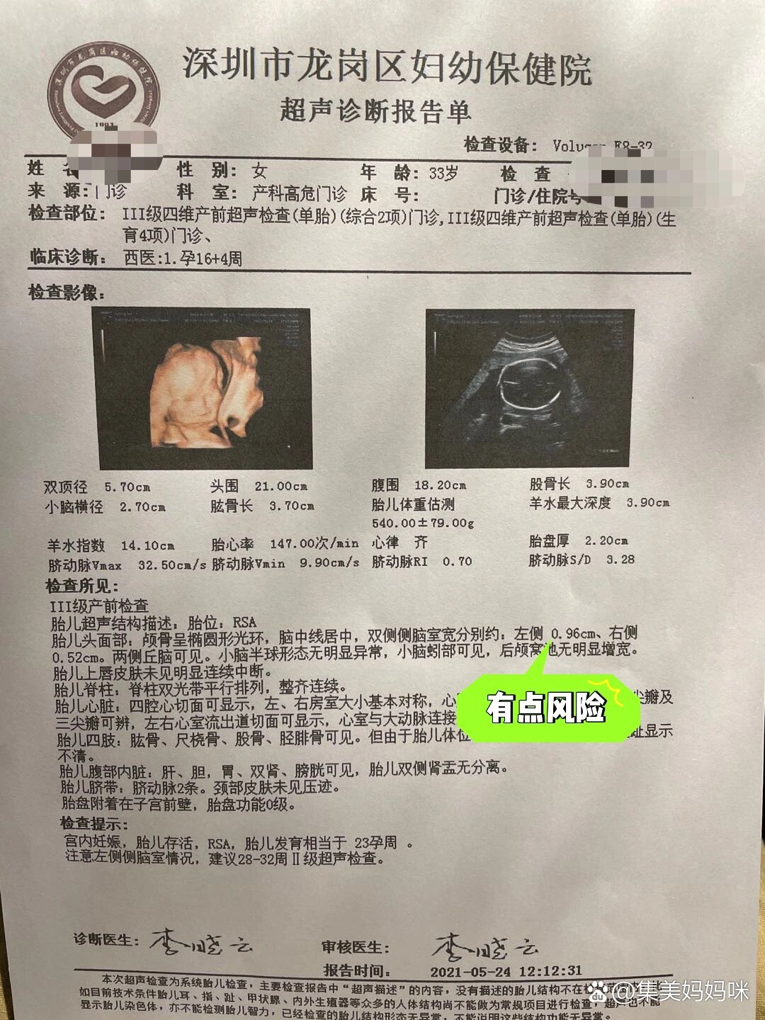 虚惊一场——胎儿侧脑室增宽