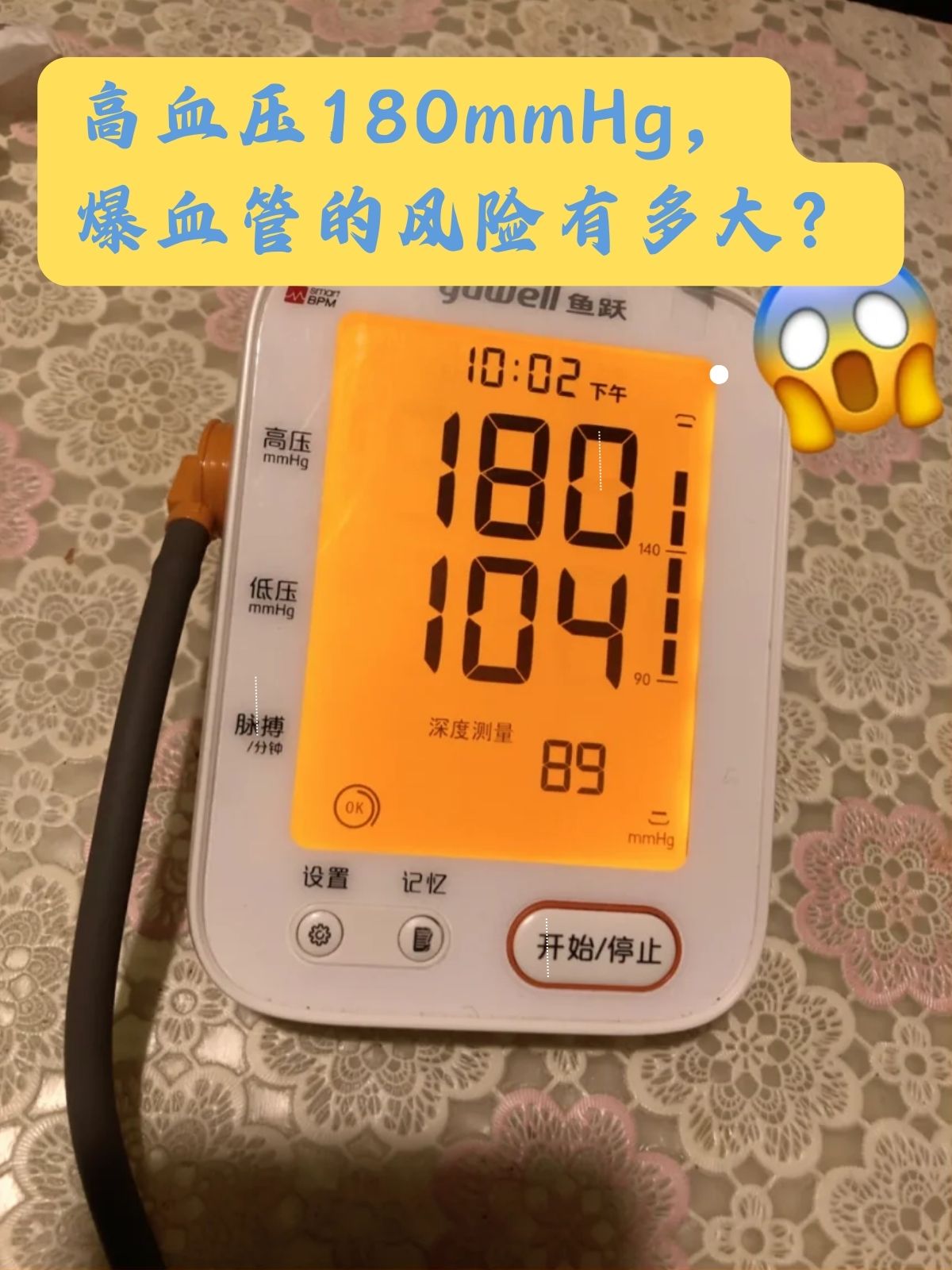 130到180的高血压图片图片