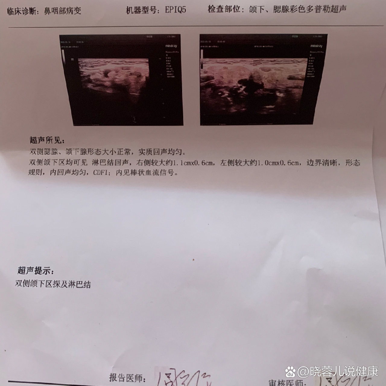 有懂淋巴结的吗?