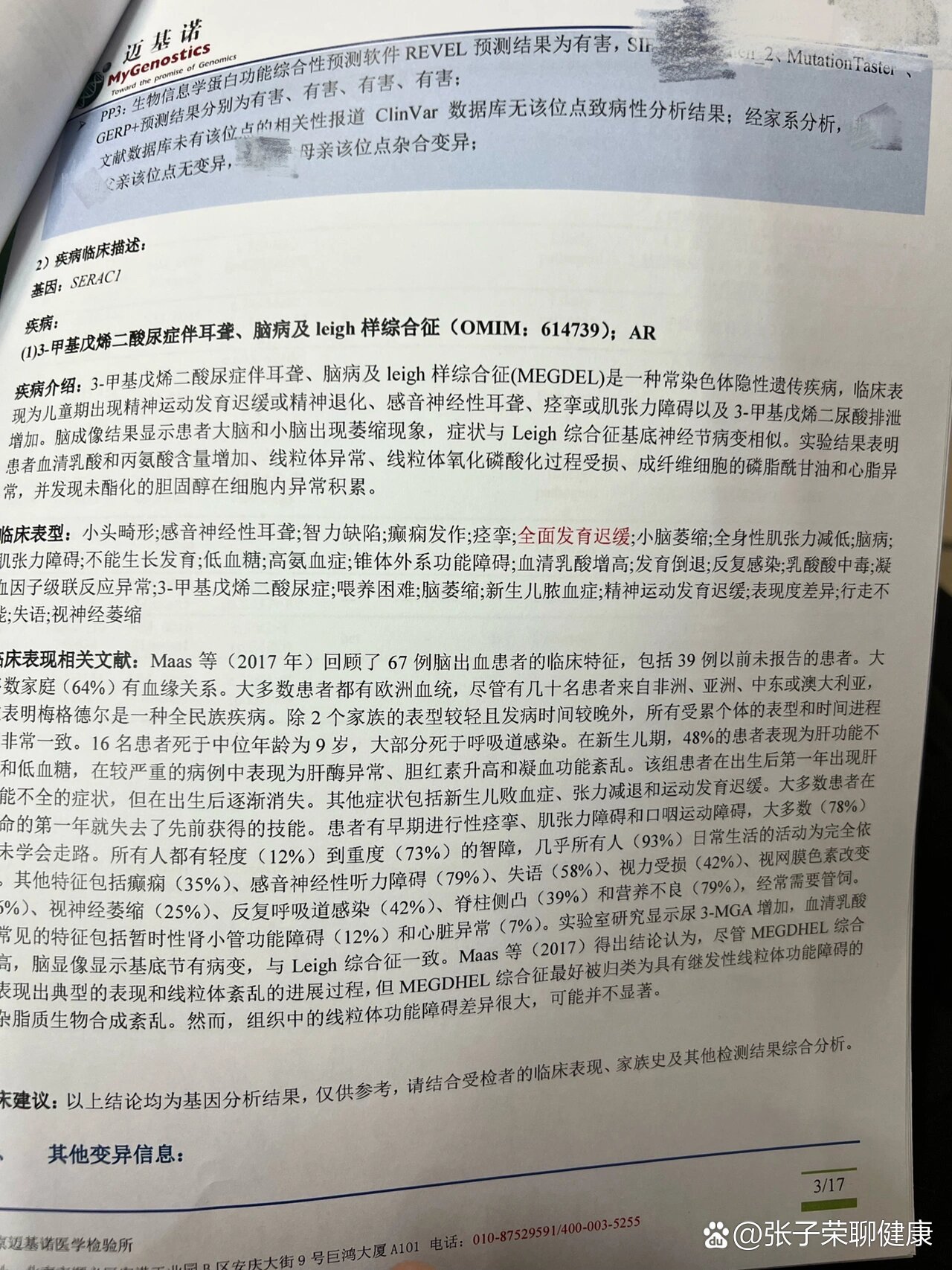 Meigs综合征 全网资源