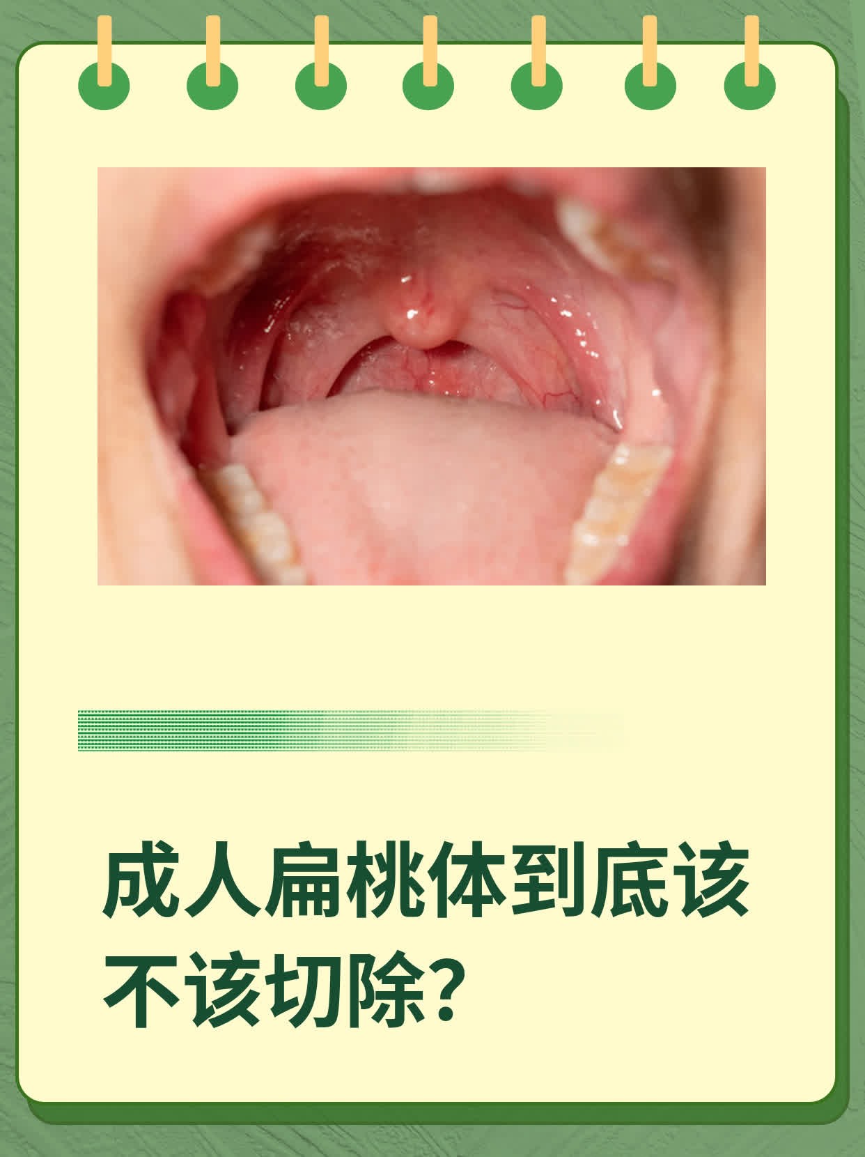 成人扁桃体到底该不该切除