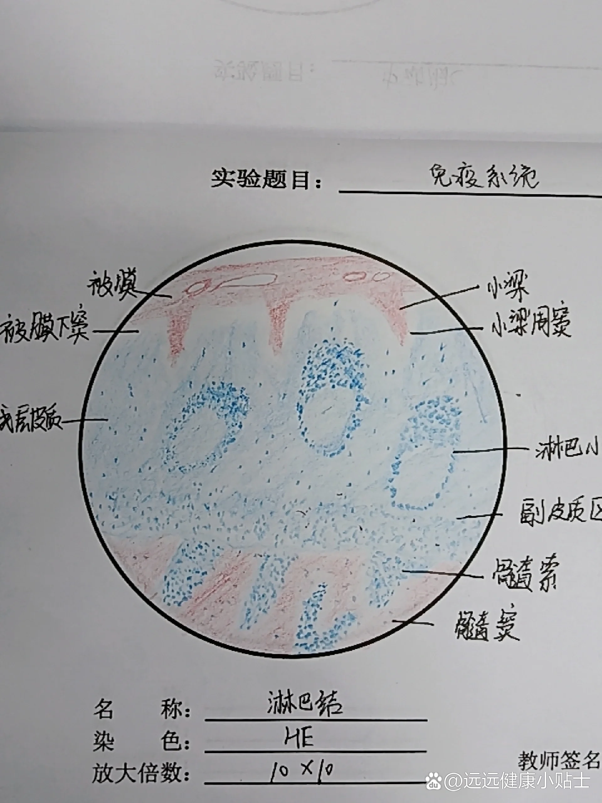 淋巴结红蓝铅笔绘图