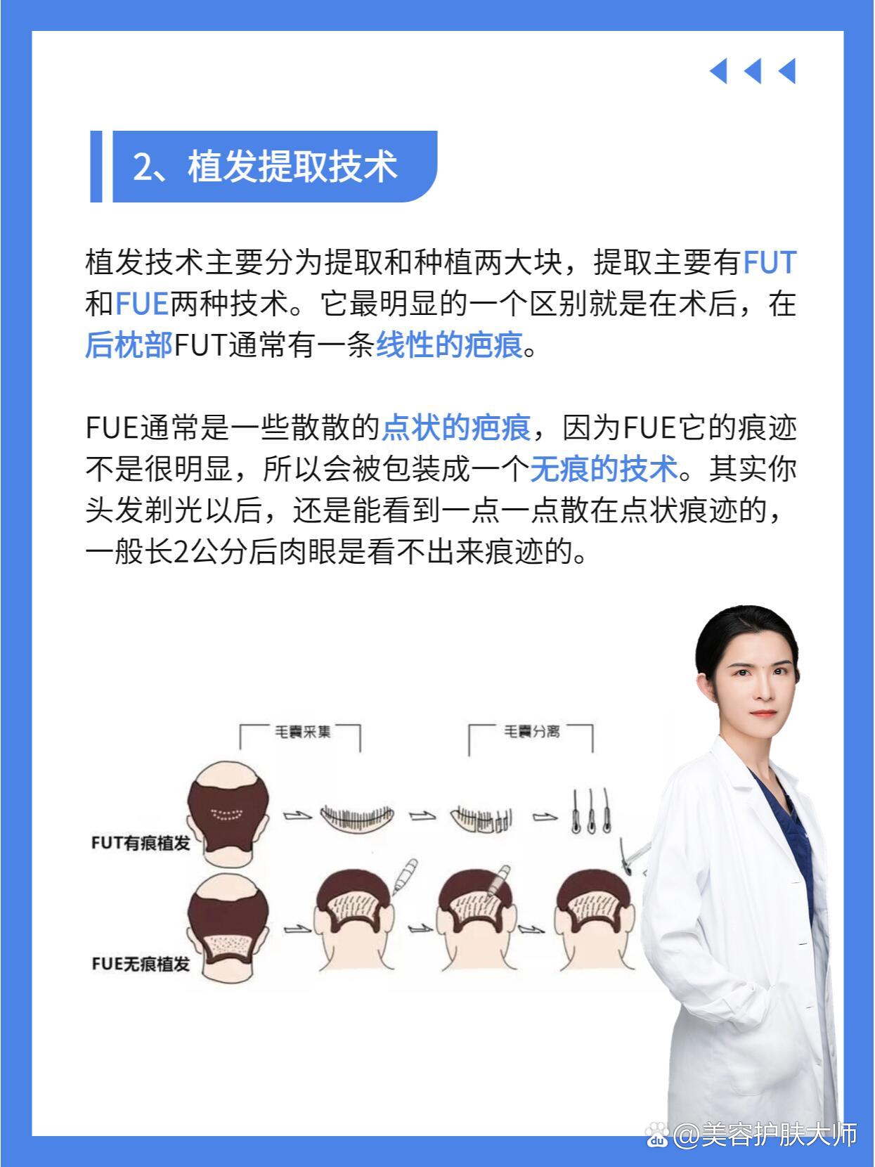 无痕植发和微针植发有什么区别?微针植发和无痕植发究竟哪个比较好?