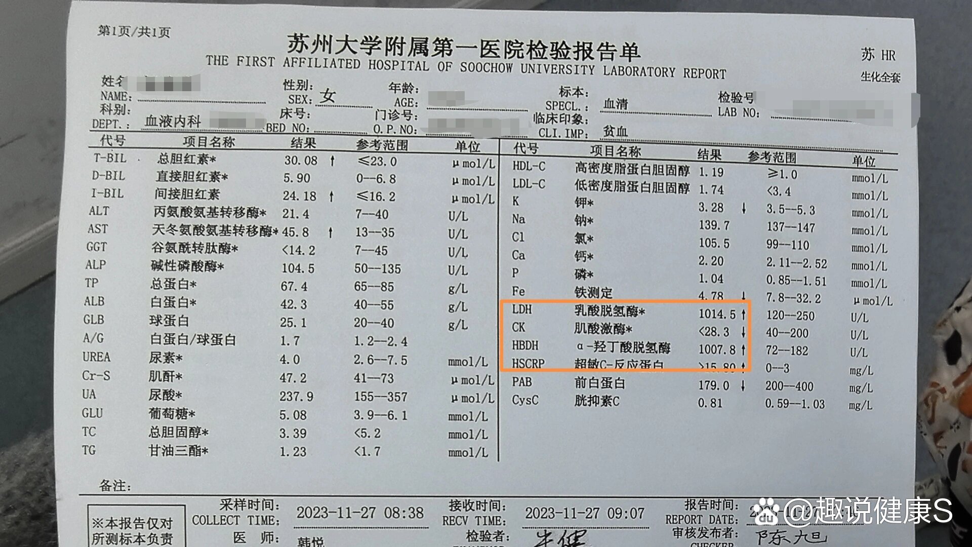溶血性贫血