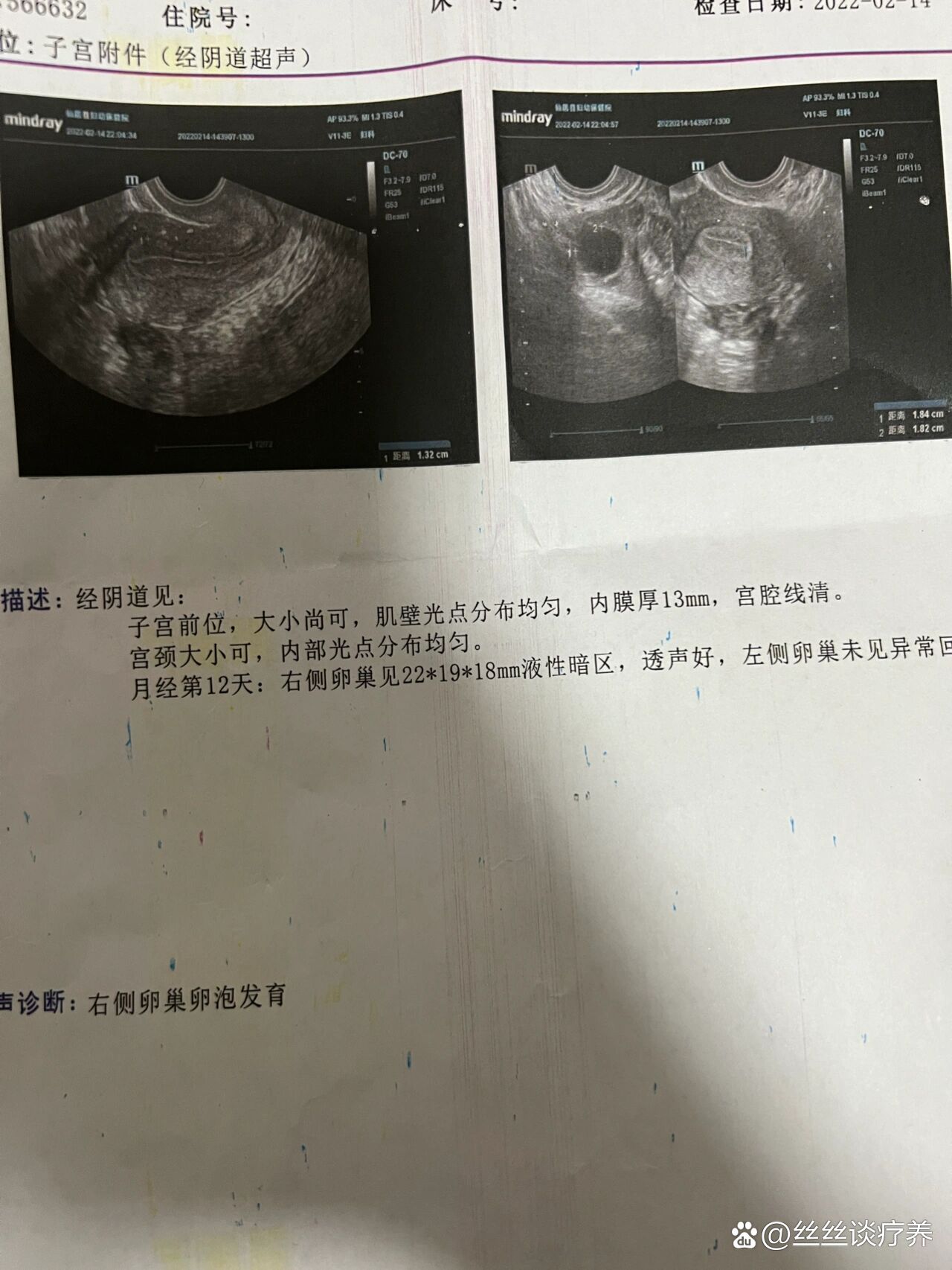 卵泡26排出来能受孕吗_卵泡26x26排出怀孕啦