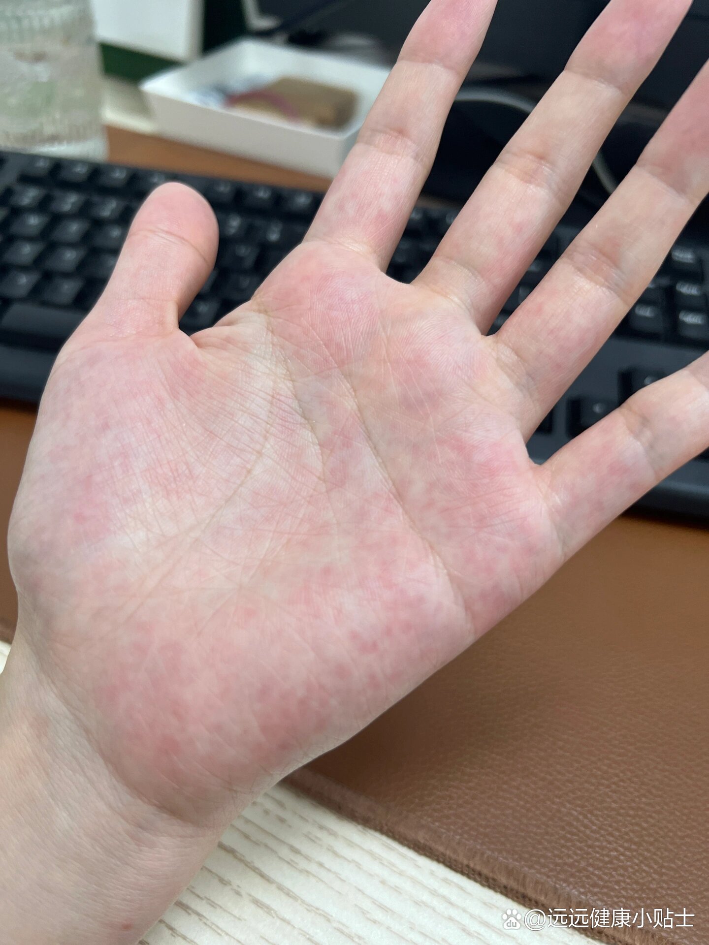 奇奇怪怪的手掌✋