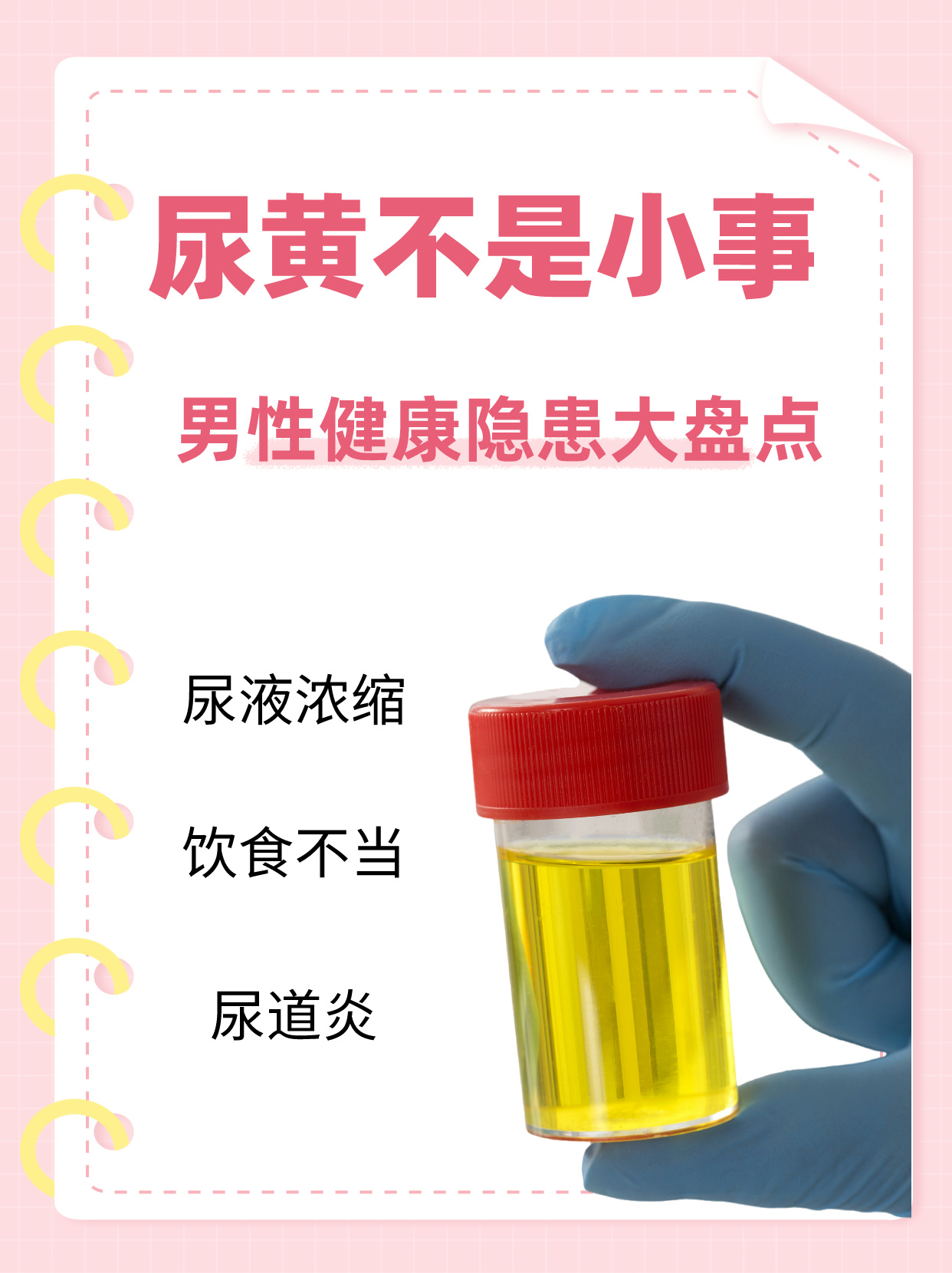  p>记得去年,有一位男性由于尿液发黄的原因来到我的门诊,在经过检查