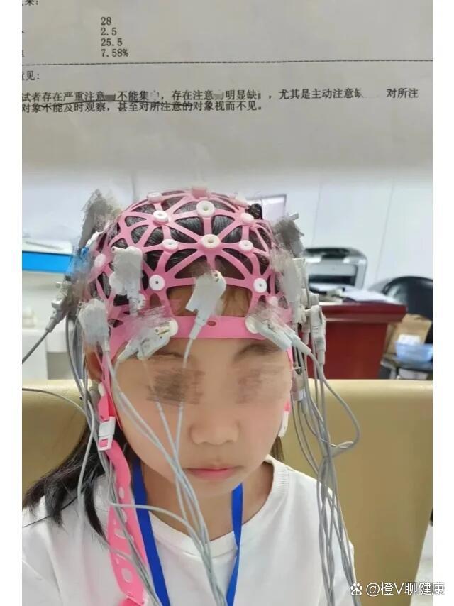 多动症孩子的眼神图片图片