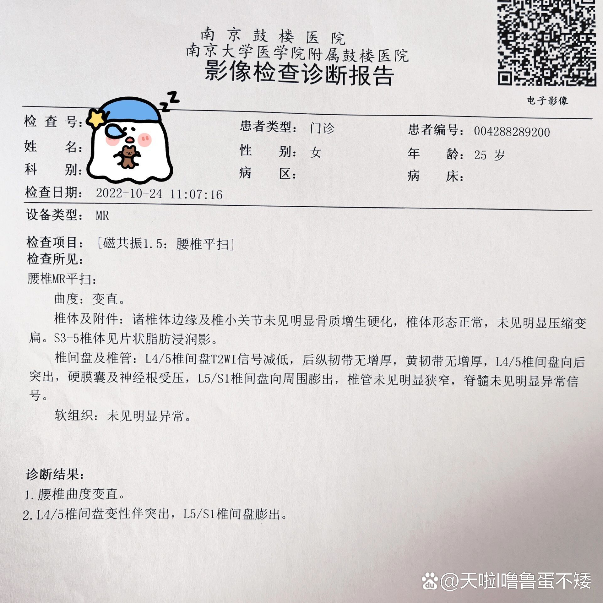 腰椎间盘突出ct报告图片