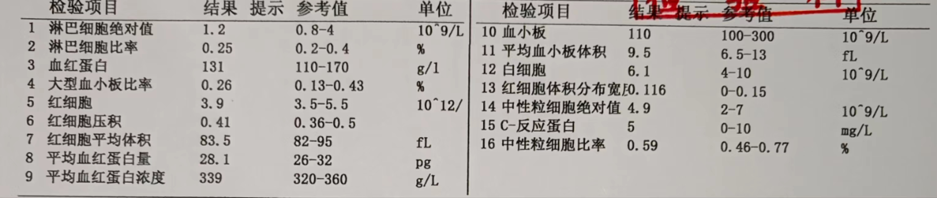皮肤和眼睛黄染,小心溶血病