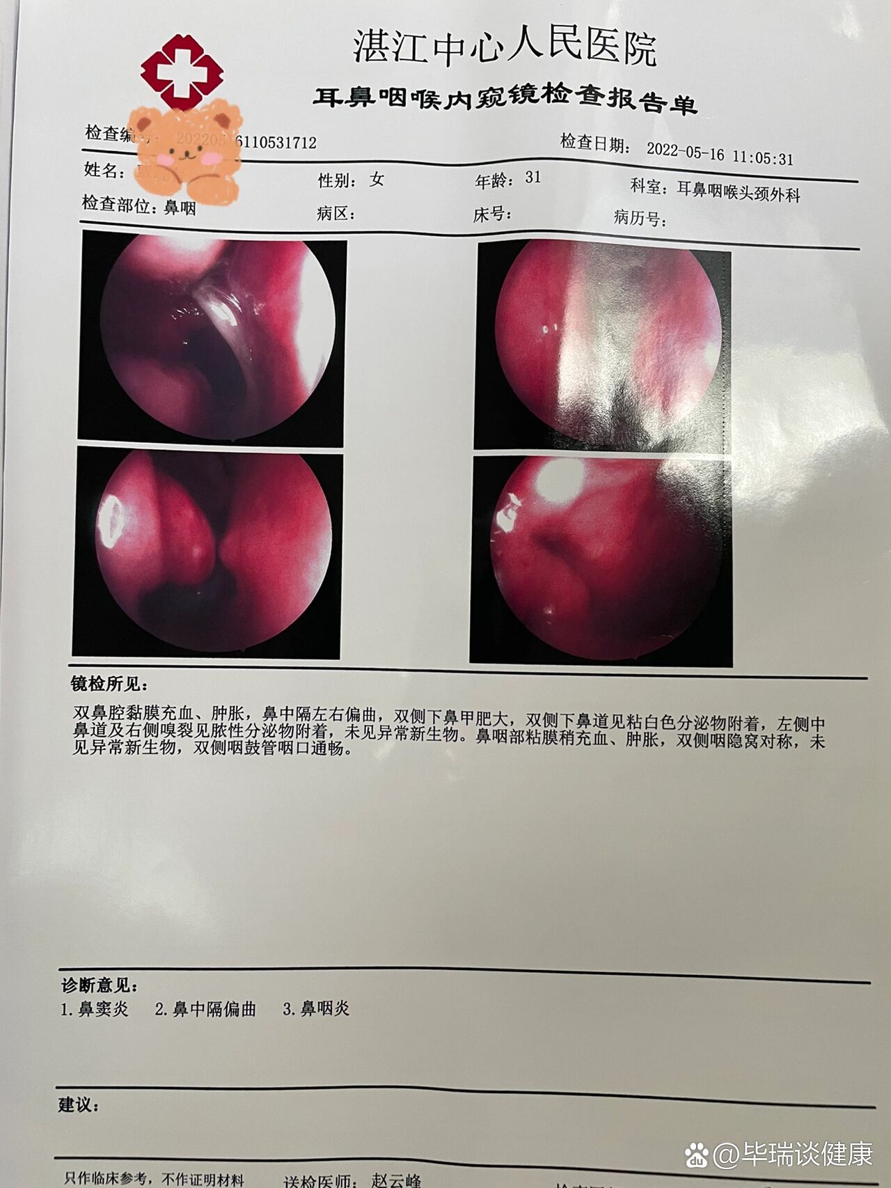 鼻腔镜多少钱图片